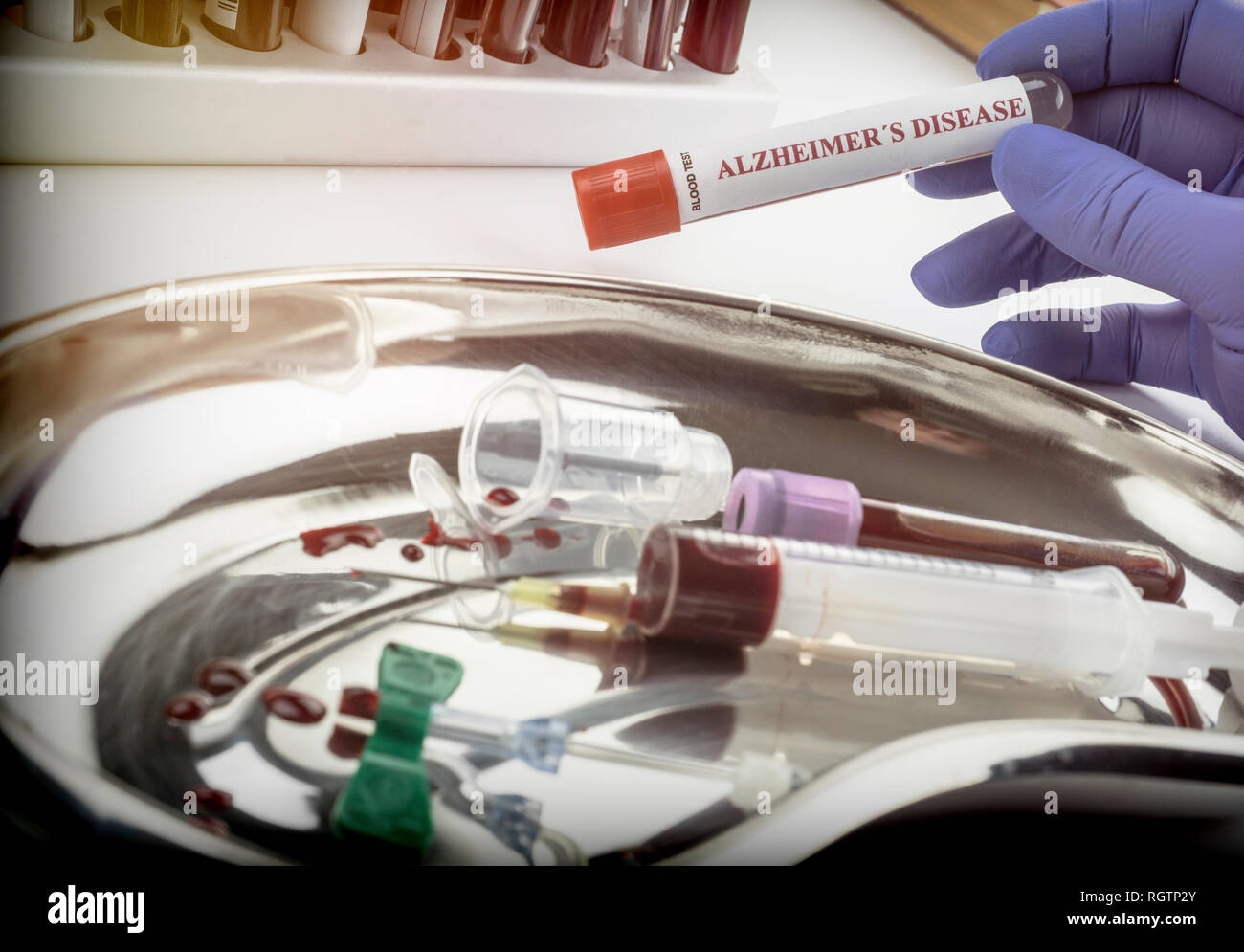 Scientist holds blood sample to investigate remedy against Alzheimer's disease, conceptual image Stock Photo