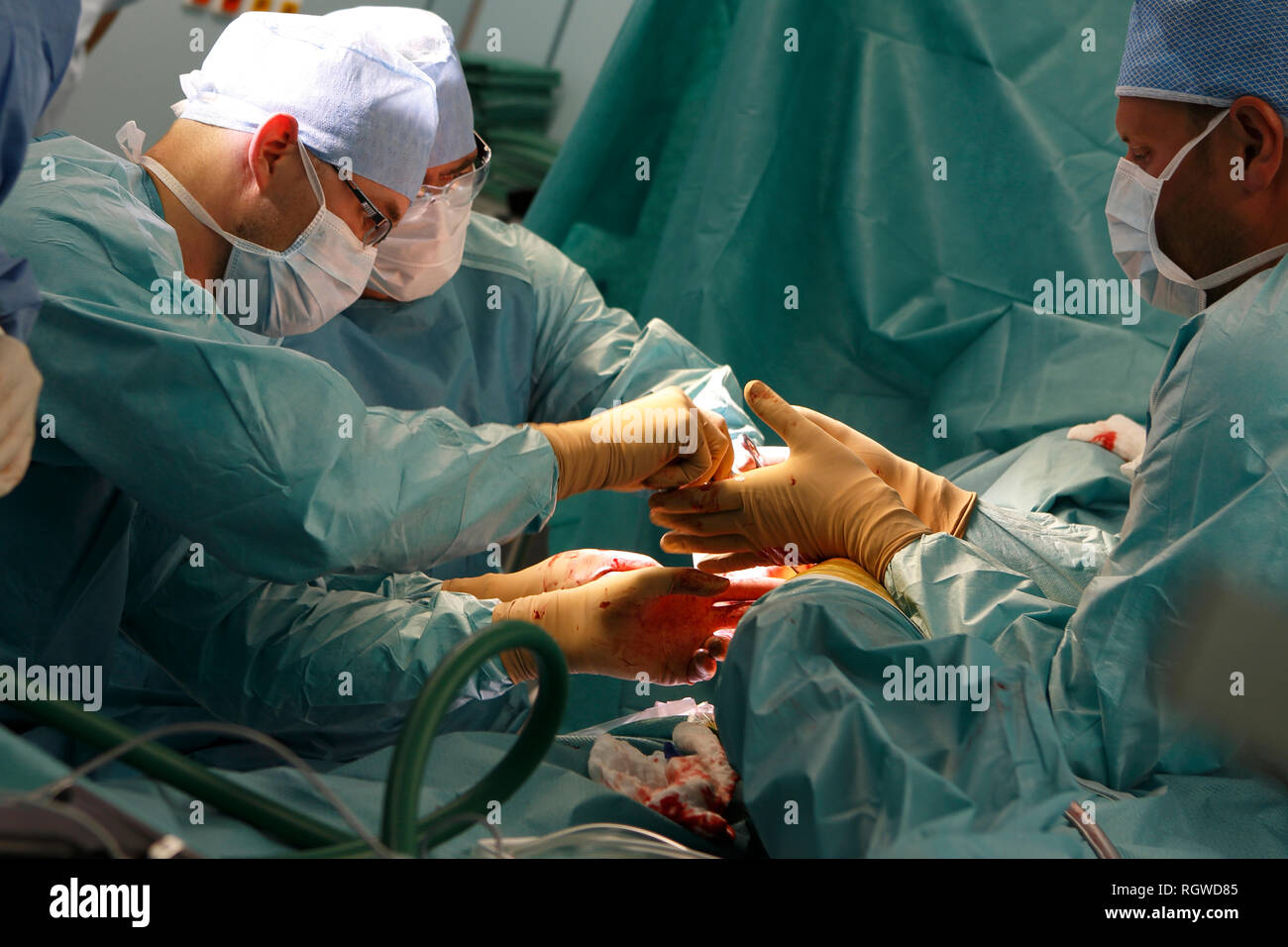 surgeons in total hip replacement surgery Stock Photo Alamy