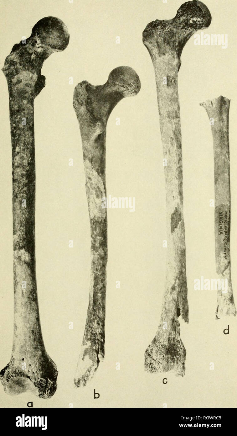 . Bulletin. Ethnology. BUREAU OF AMERICAN ETHNOLOGY BULLETIN 182 PLATE 109. Long bones from Clarksville site showing more severe types of damage: a, Right femur, USNAI 380871, showing rounded pits on anterior surface of upper and middle shaft, with some scraping of surface, b. Left femur, USNM 380854, showing denuded areas (lighter) on the posterior surface of the upper and middle shaft; dark areas represent intact bone surface, c, Right femur, USNM 380864, showing extensive denuded areas (lighter) on anterior surface, with extensive damage to condyles, d. Left humerus, USNM 380864, showing su Stock Photo