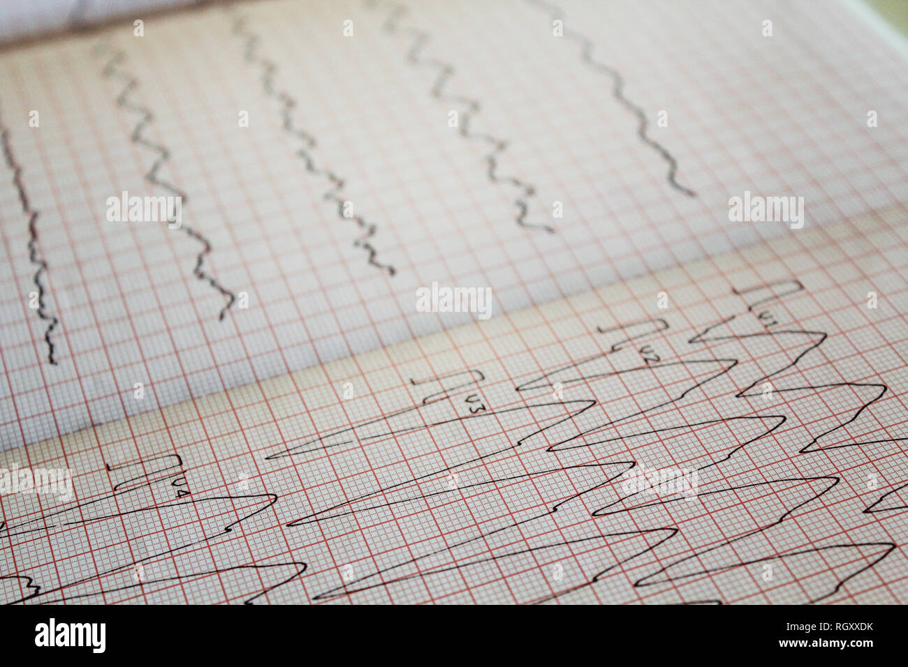 Ekg electrocardiogram closeup view concept hi-res stock photography and ...
