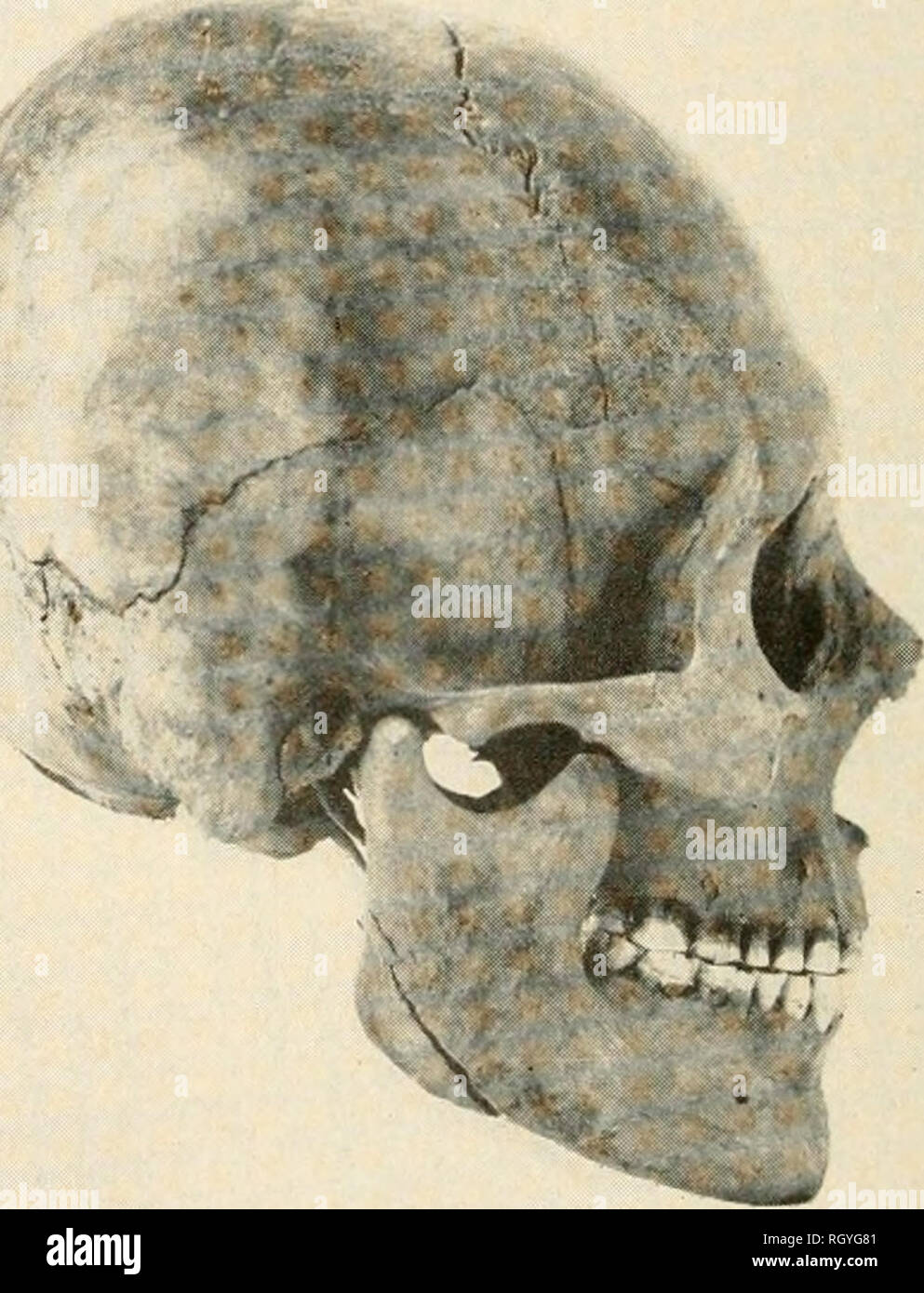Bulletin. Ethnology. Berrlan's Island skulls. Upper, No. 5, old