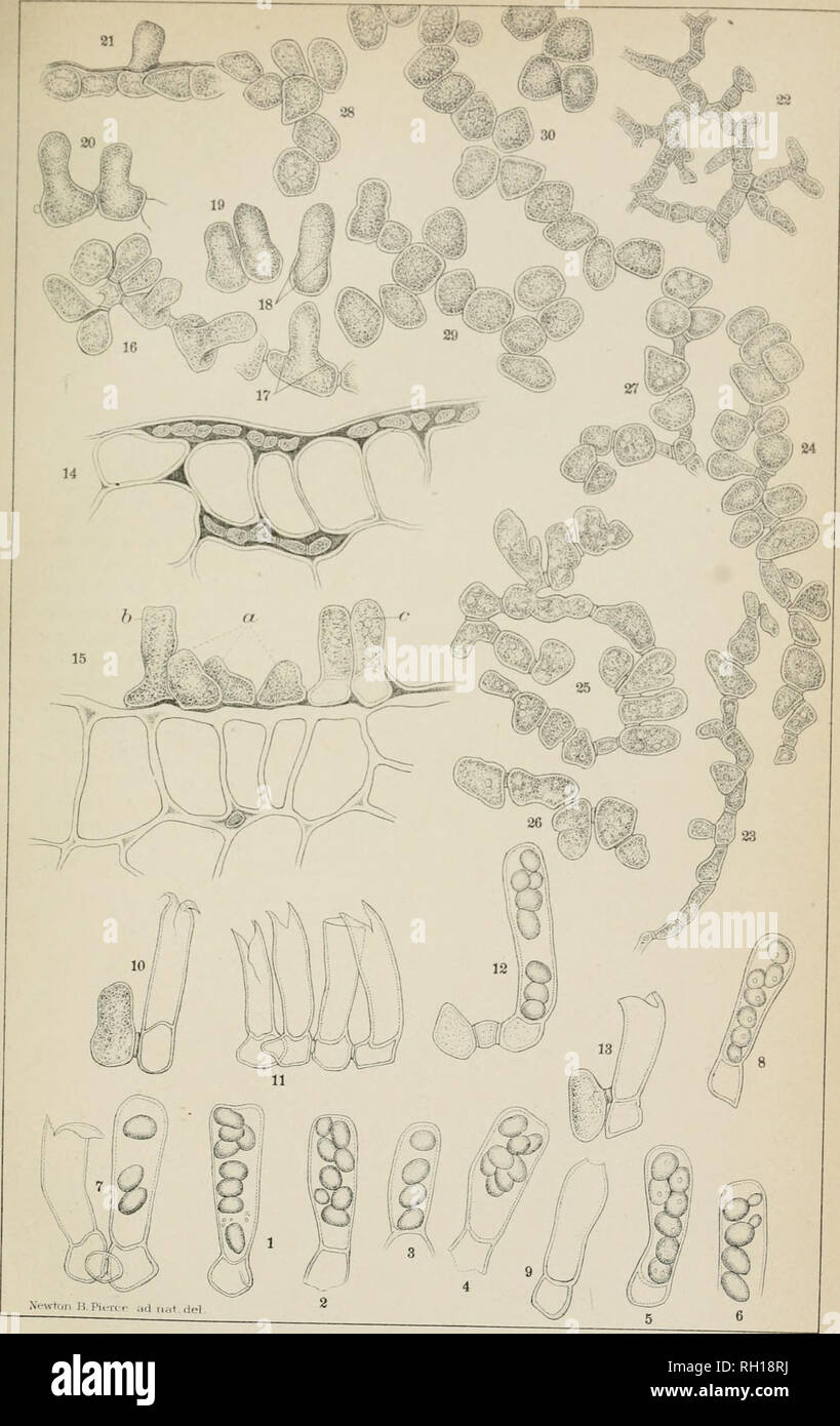 . Bulletin. Plant diseases -- United States. BULL. 20, DIV. VEG. PHYS. &amp; PATH., U. S. DEPT. AGRJCULTURE. PLATE III.. FRUITING STAGES OF EXOASCUS DEFORMANS. â ^-Hoffn A- Co.LitJi. Kiiltiniore.. Please note that these images are extracted from scanned page images that may have been digitally enhanced for readability - coloration and appearance of these illustrations may not perfectly resemble the original work.. United States. Division of Vegetable Physiology and Pathology. Washington : G. P. O. Stock Photo