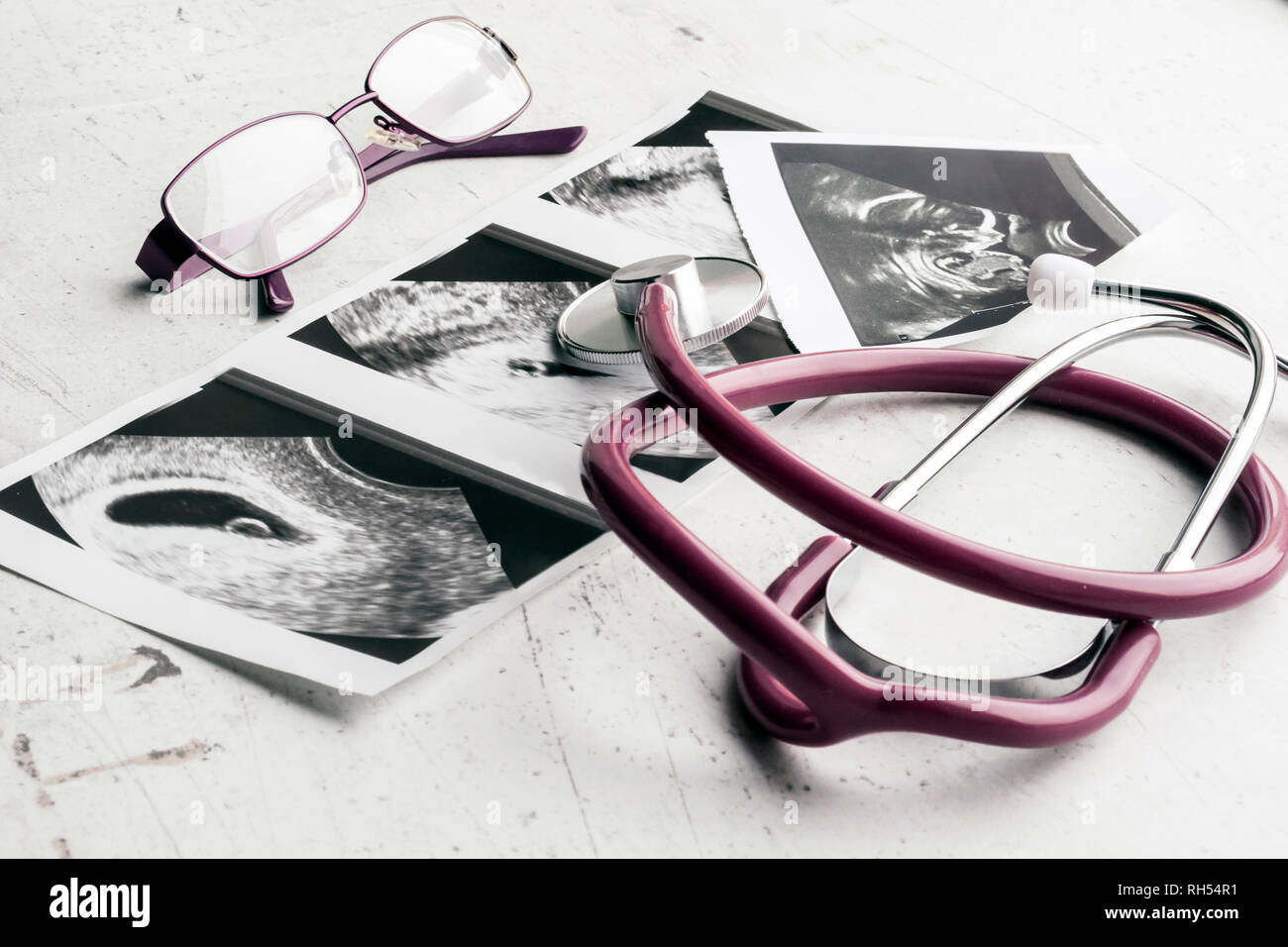 Fetus 20 weeks hires stock photography and images Alamy