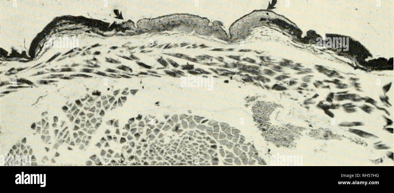 Reticular connective tissue hi-res stock photography and images - Alamy