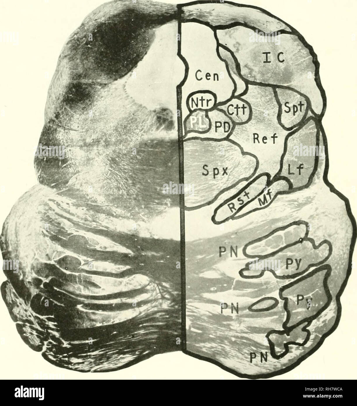 . The brain from ape to man; a contribution to the study of the evolution and development of the human brain. Brain; Evolution; Pongidae. FIG. 308. CORILLA. LE EL Ol- THE INFERIOR COLLICULUS. CEN, Central Gray Matter; err. Central Tegmental Tract; ic. Inferior Colliculus; if. Lateral Fillet; mf, Mesial Fillet; ntr. Trochlear Nucleus; i&gt;d, Predorsal Bundle; i&gt;l. Posterior Longitudinal Fasciculus; I'N, Pontile Nuclei; i&gt;Y, Pyramid; ref, Reticular Formation; kst, Rubrospinal Tract; spt. Spinothalamic Tract; si&gt;x. Crossing of Superior Cerebellar Peduncle. [Accession No. .1. D. Section Stock Photo
