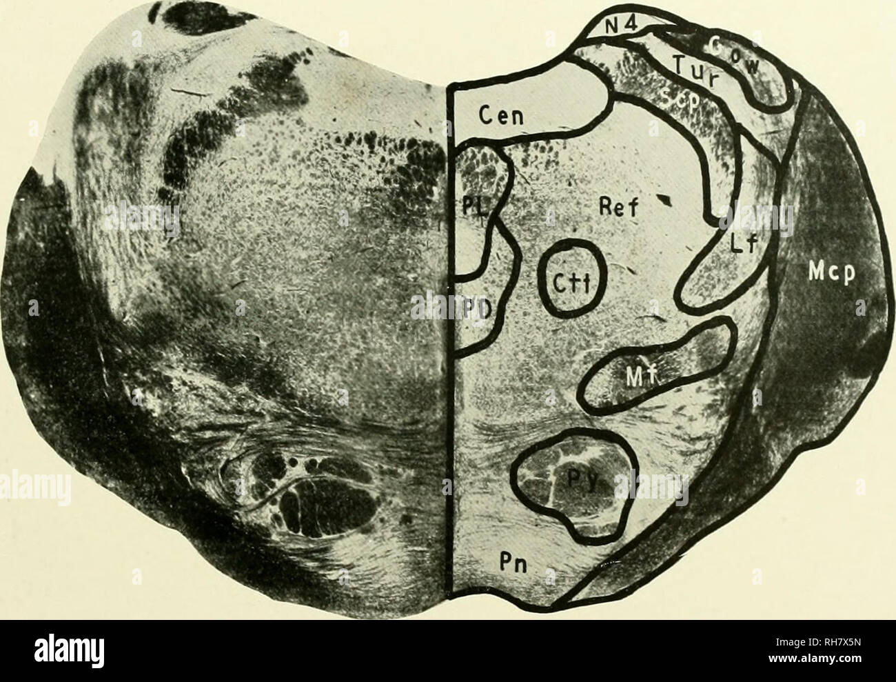 The brain from ape to man; a contribution to the study of the evolution and development of the human brain. Brain; Evolution; Pongidae. CALLITHRIX JACCHUS, THE MARMOSET 173 animal docs not The brain from ape to man; a contribution to the study of the evolution and development of the human brain. Brain; Evolution; Pongidae. CALLITHRIX JACCHUS, THE MARMOSET 173 animal docs not