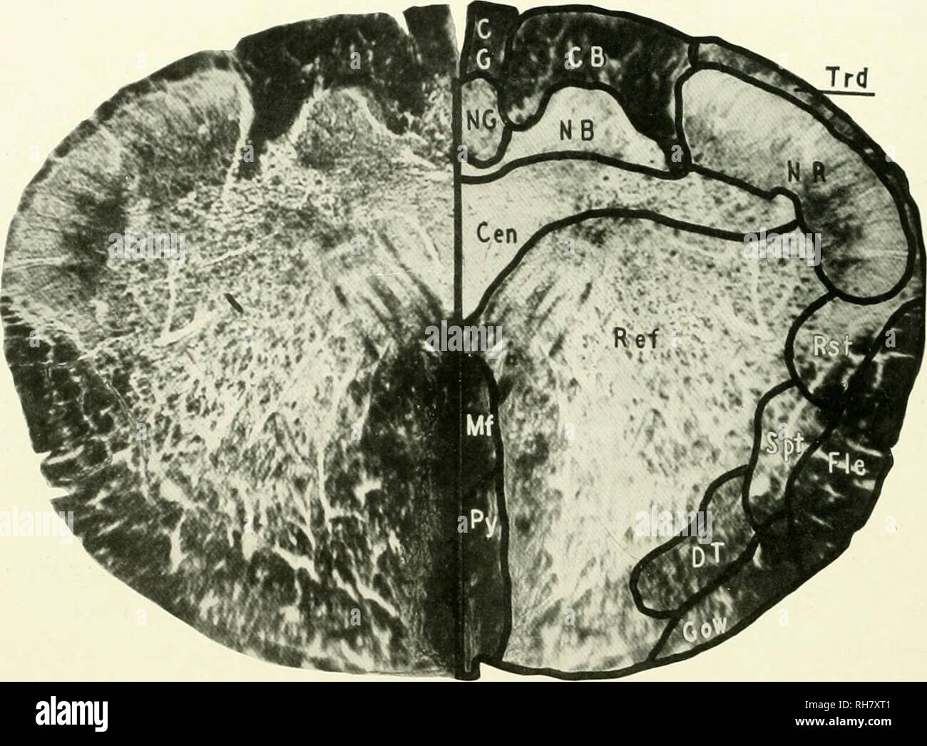 The brain from ape to man; a contribution to the study of the evolution and development of the human brain. Brain; Evolution; Pongidae. io6 THE LOWER PRIMATES like capacity, aiding the The brain from ape to man; a contribution to the study of the evolution and development of the human brain. Brain; Evolution; Pongidae. io6 THE LOWER PRIMATES like capacity, aiding the