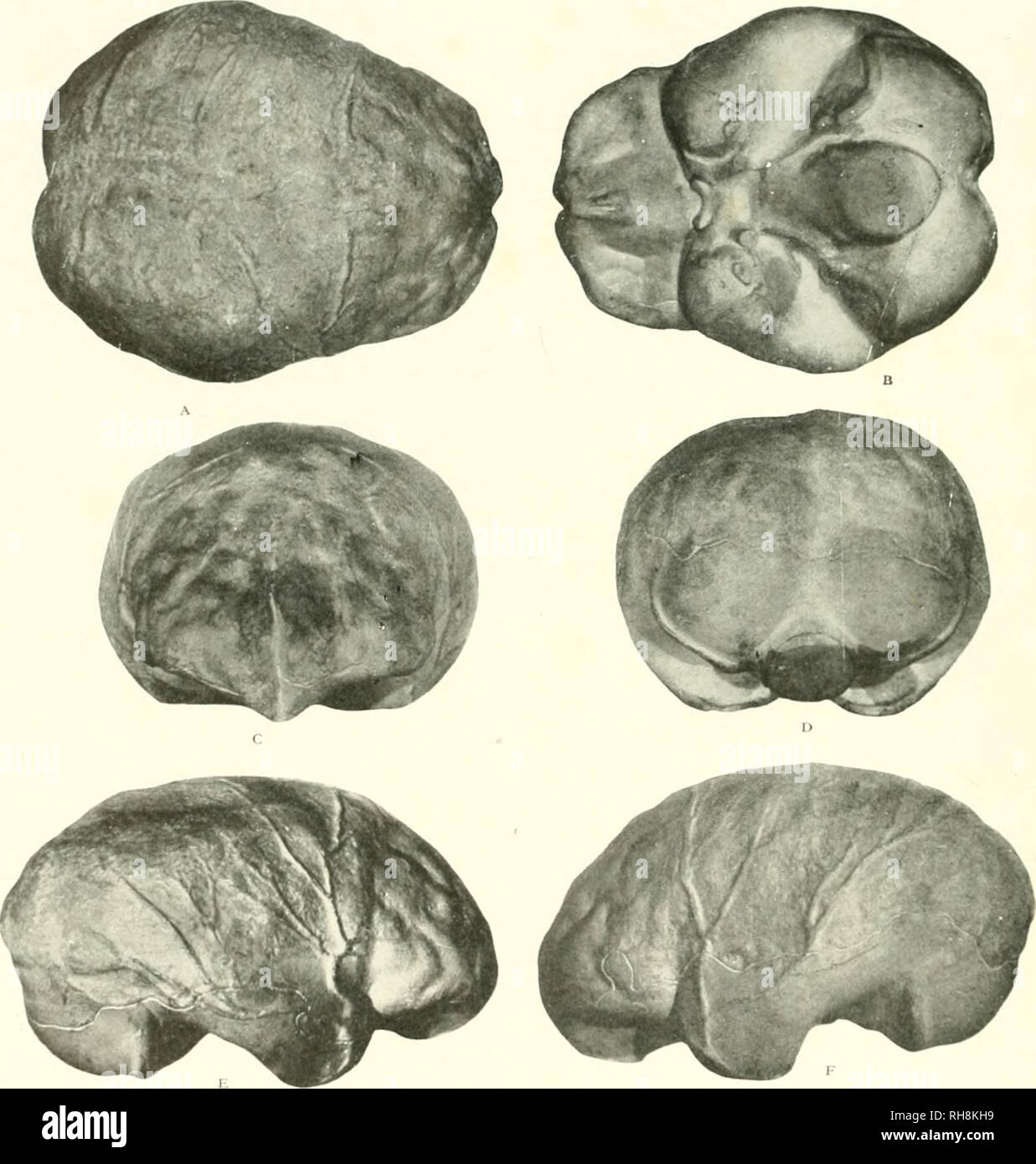 . The brain from ape to man; a contribution to the study of the evolution and development of the human brain. Brain; Evolution; Pongidae. FIGS. 366 TO 371. SIX MEWS OI- THE ENDOCRAMAL CAST OF PITHECAN- THROPUS ERECTUS (JAVAN APE-.MAN) THE MOST PRIMIIIXF KNOWN REPRE- SENTATIVE OF THE HUMAN FAMILY. ESTIMATED ANIiyLII'i OF FOSSIL 500,000 YEARS. RESTOKA 1 lONK B'l PROF. J. H. MCGREGOR. (a) Vertex, (d) Base Restored. ((;/ ItdiUmI Pole. M)) Oeei|)it.il Pole, (e) Riglu Lateral Surfaee. (1) Left Lateral surface. The frontal convolutions and br.inclies of the middle meningeal artery are especially well Stock Photo
