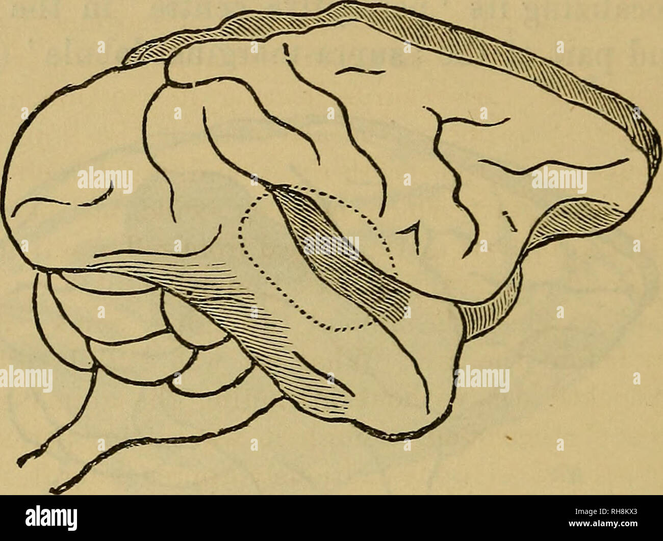 The Brain As An Organ Of Mind Brain Thought And Thinking Brain 634 Phrenology Old And New Eyes Ancl Did Not Subsequently Recover From This Condi Tion Instead Of A Temporary The Brain As An Organ Of Mind Brain Thought And Thinking Brain 634 Phrenology Old And New Eyes Ancl Did Not Subsequently Recover From This Condi Tion Instead Of A Temporary