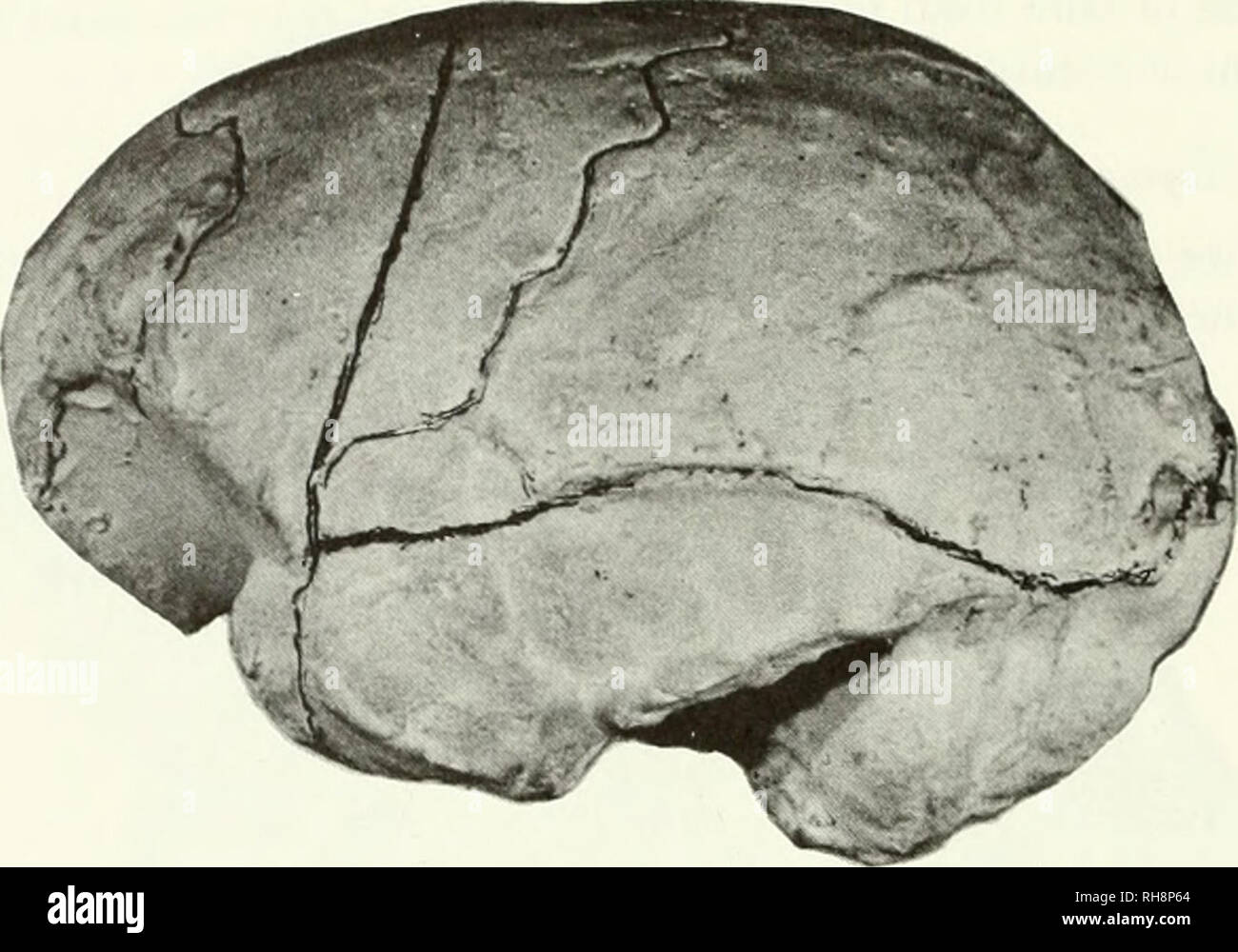 . The brain in hominid evolution. Human evolution; Brain; Fossil