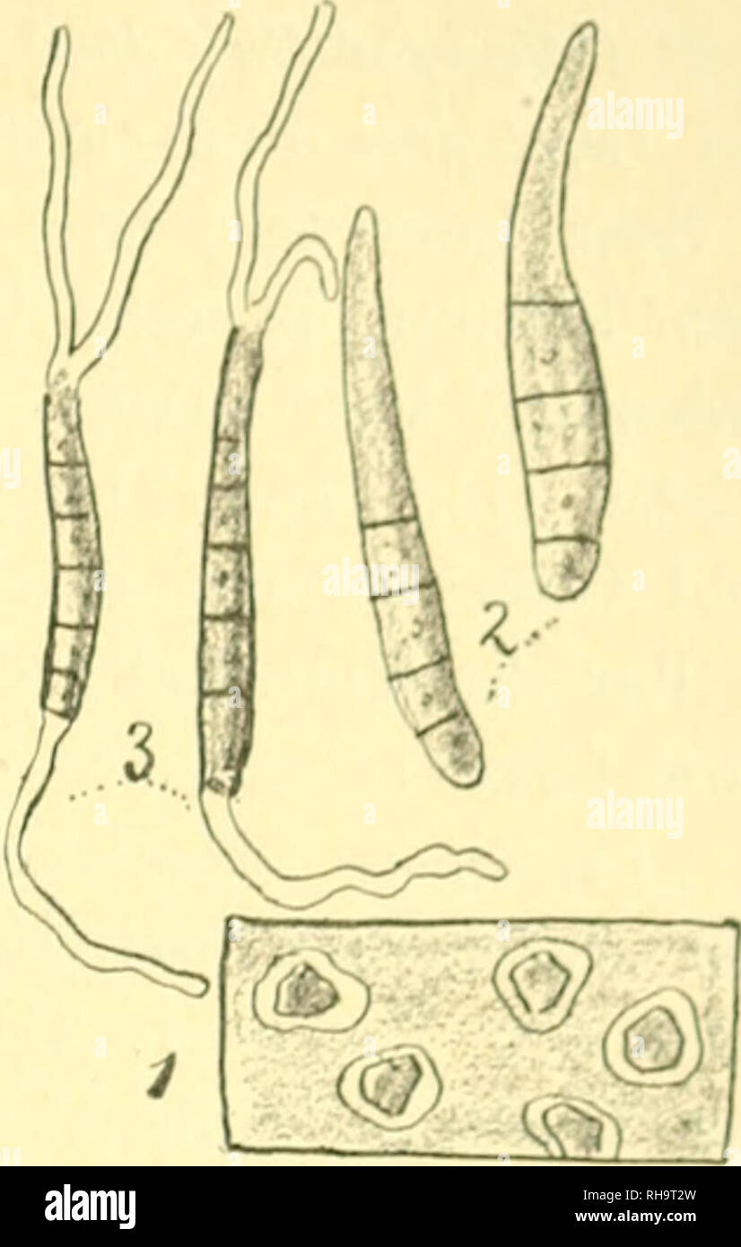 . Botanische Untersuchungen ber einige in Java vorkommende Pilze, besonders ber Bltter bewohnende, parasitisch auftretende Arten. Fungi -- Indonesia Java; Phytopathogenic fungi -- Indonesia Java. BOTANISCHE UNTERSUCHUNGEX, TJ. S. W. 3.37 1â2 niilliin. diam. , iimiierosissimis, pa^iiiain iiiieriorem tolioriiiii occupantibus, supia pallide bnmneis; hvpliis l'uligiiieis cyliiidraceis 1â2 sÃ¼ptatis, 20â24 X 3â4/x coni- diis vcriniculaiihiis olivaceis , ;iG â47X 5â5 J /x plcruniquc 4G X ^ l-f- Parasitiscli auf lebenden erwachsenen BlÃ¤ttern von einem aiio-epflanzten Baum von Mnngifera indica Linn.  Stock Photo