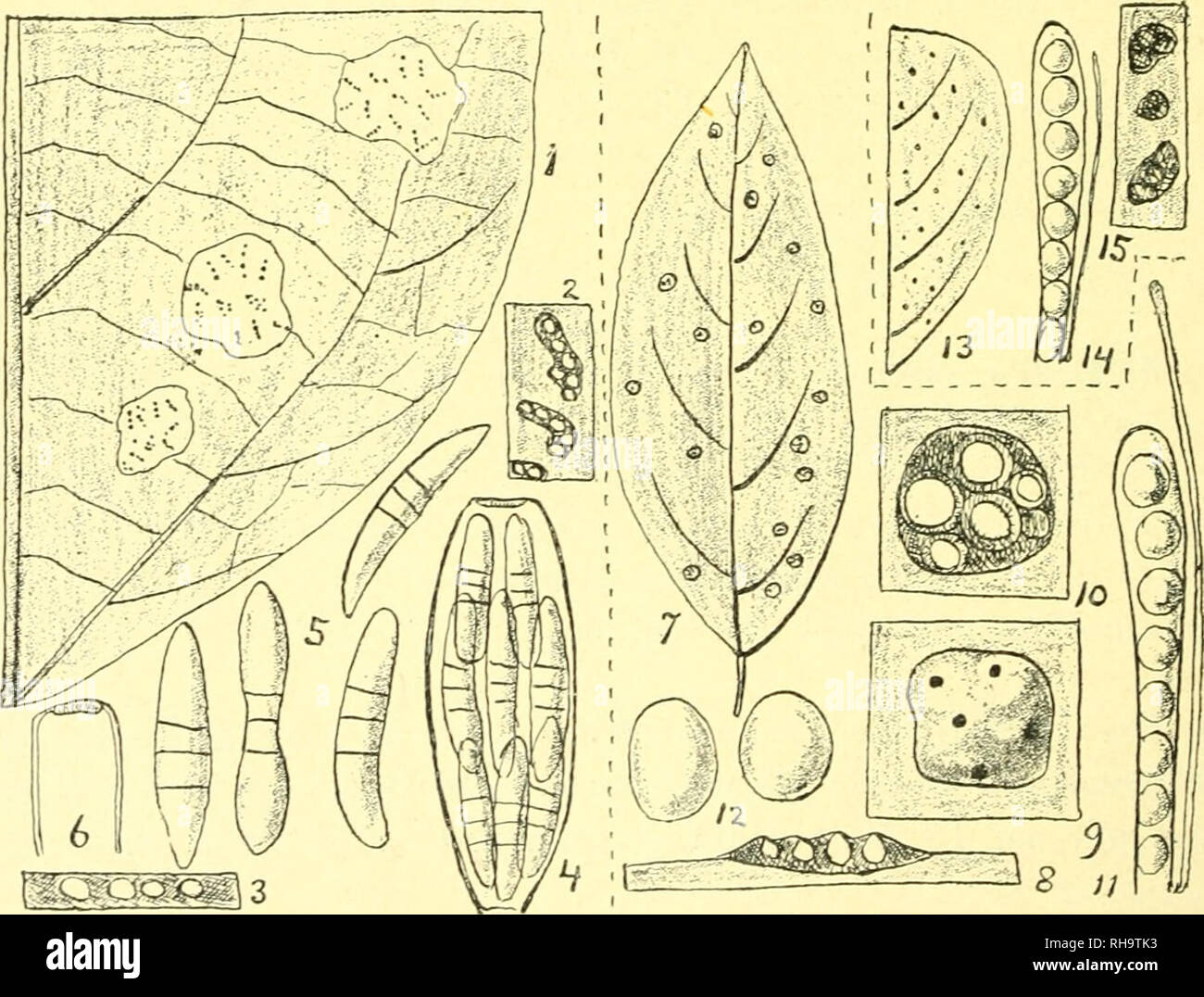 . Botanische Untersuchungen ber einige in Java vorkommende Pilze, besonders ber Bltter bewohnende, parasitisch auftretende Arten. Fungi -- Indonesia Java; Phytopathogenic fungi -- Indonesia Java. 180 BOTANISCHE UNTEllSUCHUNGEN, U.S.W. Teilsporen zerfüllencn fadenförmigen Ascosporen; reclits (lanchcii eine noch nicht zerfallene Ascospore. — Fig. 13, 17. Art der P)il- dung der Teilsporen (nach getrocknetem jMaterial; scheniatisirt).— Fig. 13, 18. Teilspore; nach lebendem Material. 3. ÜOTHI DEALES. 1) 0 T II I ) i: A C E A E. TelliiHiia Erjllirinae Raciborski Parasitische Algen w. Pilze 1 (190Ü) Stock Photo