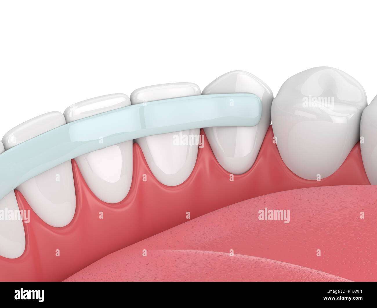 render of teeth 