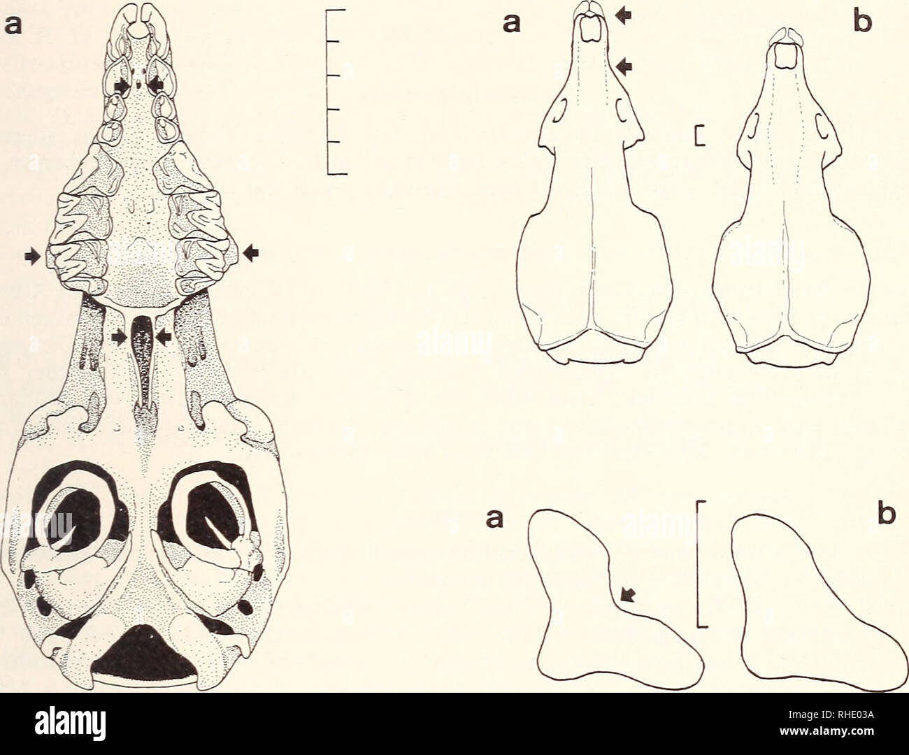 Condylay Process Condylar process hi-res stock photography and images - Alamy