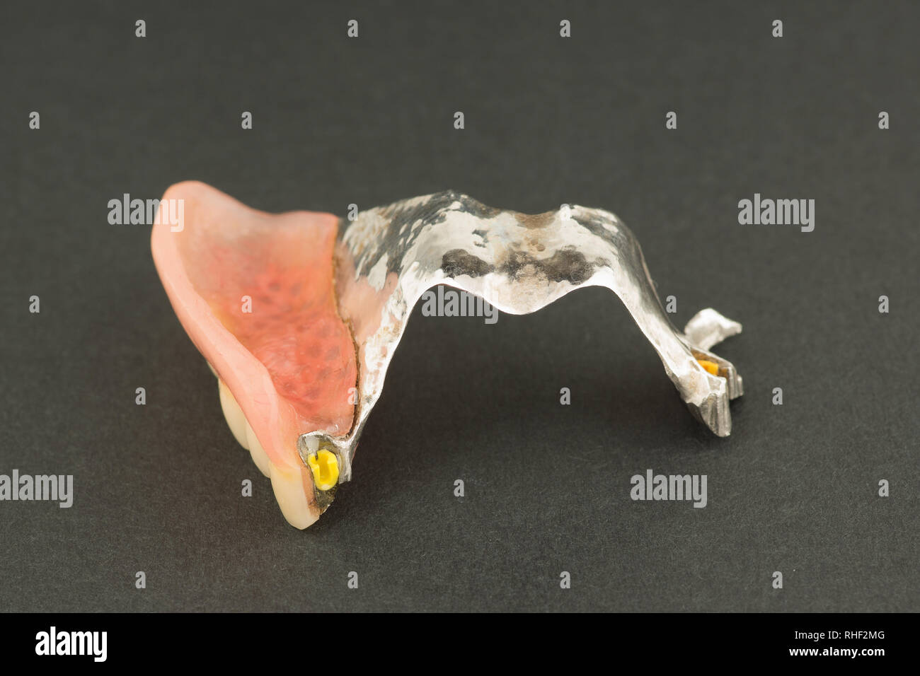 image of a modern arc  denture with attachment on a black background Stock Photo