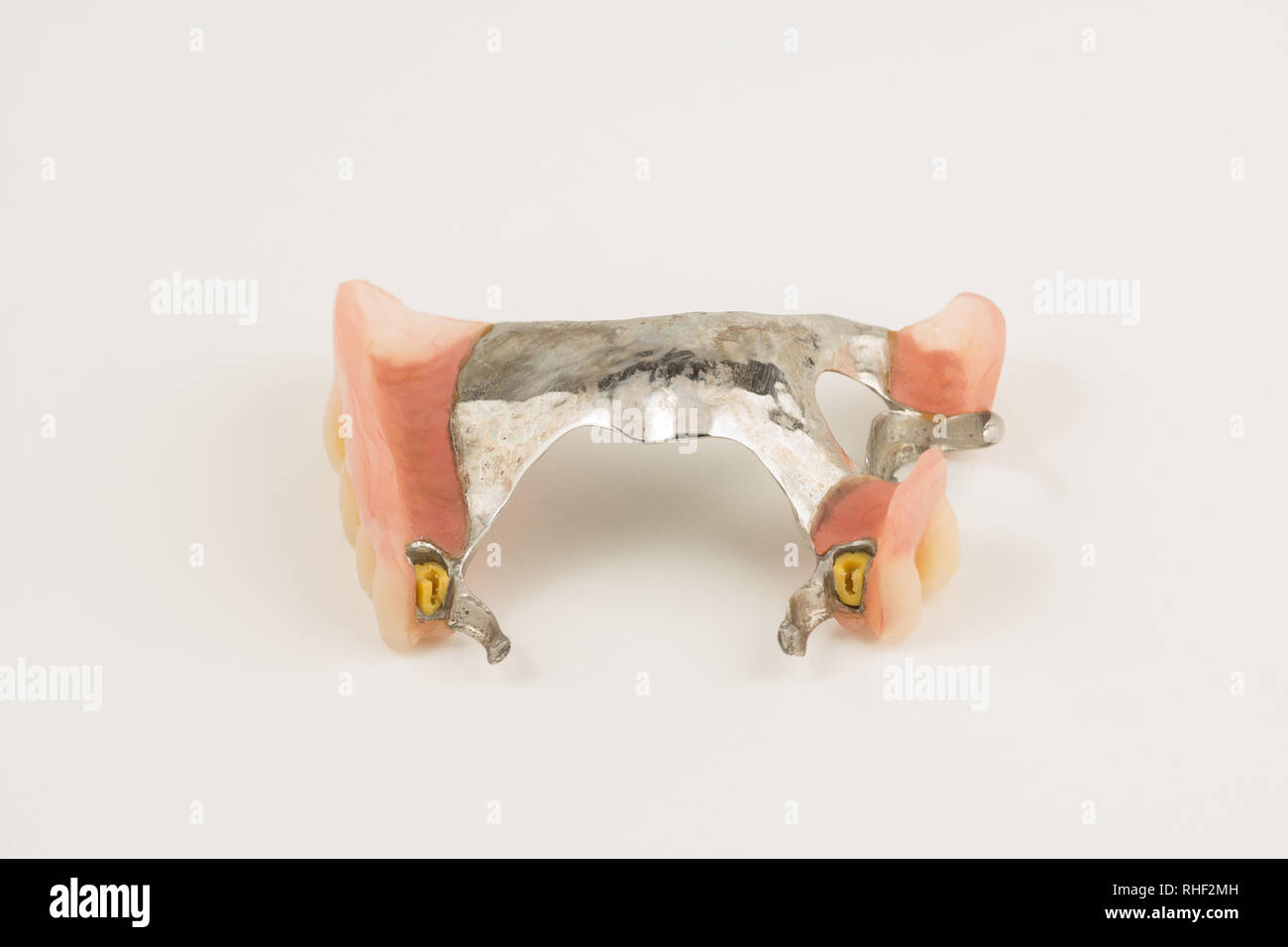 bugel remove dentures with attachments on white background Stock Photo