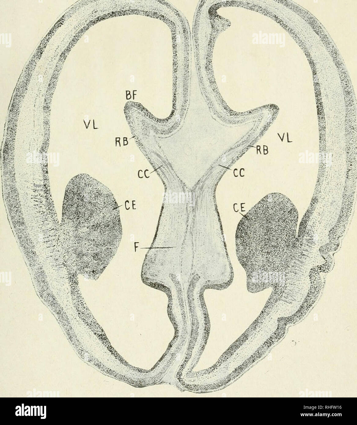 Cuerpo calloso del cerebro hi-res stock photography and images - Alamy