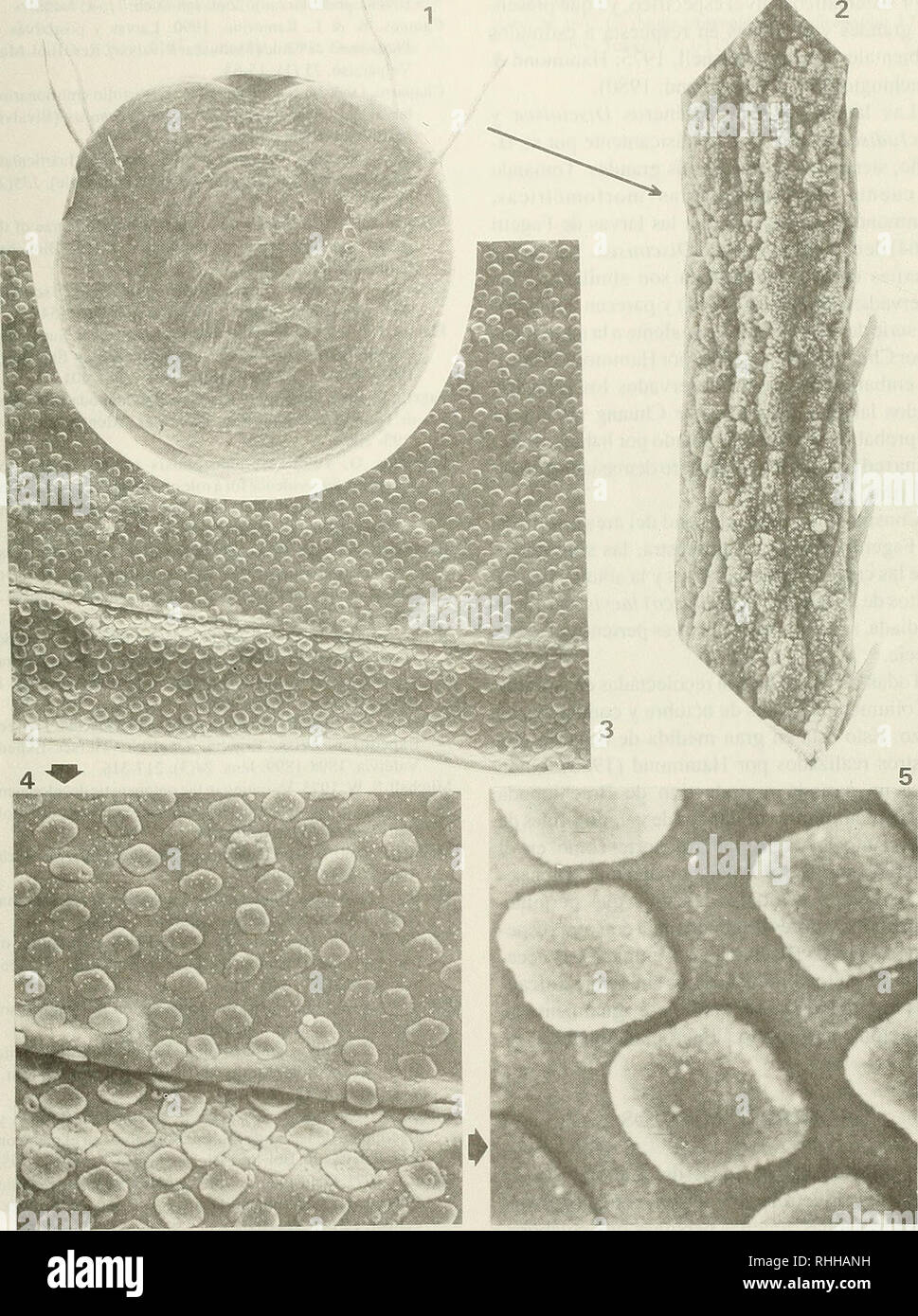 . Boletin de la Sociedad de Biología de Concepción. Sociedad de Biología de Concepción; Biology; Biology. Bol. Soc. Biol. Concepción, Chile. Tomo 68, 1997. LAMINA 1. Larva de Oisciniscu (Discinisca) lacvis, obtenida treme a Bahía Coliumo (Chile central), observada al microscopio electrónico de barrido. 1. Vista general de la larva (xl20), 2. Vista parcial de la seta larval principal 2 (x4000), 3. Vista del borde de las valvas (xl.20ü), 4. Línea concéntrica en el borde la valva (x4.()()ü) y 5. Tubérculos valvares (xló.000). 23. Please note that these images are extracted from scanned page image Stock Photo