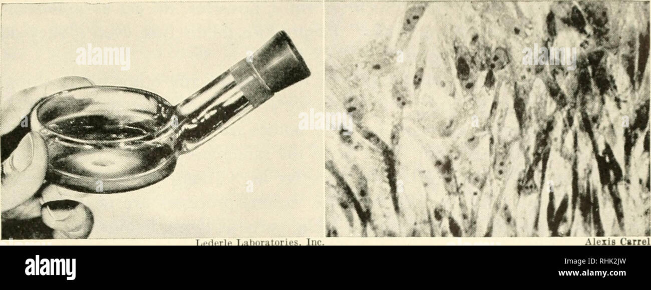 https://c8.alamy.com/comp/RHK2JW/biology-and-man-biology-human-beings-liiiirle-laljuiatorics-jin-the-culture-of-immortal-chicken-tissue-in-the-laboratory-in-1912-dr-alexis-carrel-of-the-rockefeller-institute-removed-tiny-pieces-of-heart-muscle-from-a-chicken-embryo-still-inside-the-egg-shell-at-about-the-ninth-or-tenth-day-of-hatching-he-placed-these-fragments-in-a-nutritive-medium-kept-at-a-suitable-temperature-and-supplied-with-air-every-two-days-the-growing-piece-doubled-in-size-it-was-divided-and-a-part-placed-in-a-fresh-medium-this-has-been-going-on-for-all-those-years-most-of-the-new-growth-has-of-cou-RHK2JW.jpg