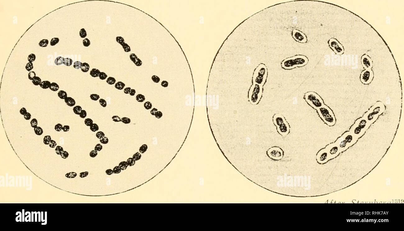 . The biology of pneumococcus; the bacteriological, biochemical, and immunological characters and activities of Diplococcus pneumoniae. Streptococcus pneumoniae; Streptococcus pneumoniae; Immunity; Immunity; Streptococcus pneumoniae. Figure 1 Figure 2. Figure 3 Figure 4 After Sternberg1 MICROCOCCUS PASTEURI, 1885 Figure 1. Micrococcus Pasteuri from blood of rabbit inoculated sub- cutaneously with normal human saliva (Dr. S.). Stained by the method recommended by Friedlander. Magnified 1000 diameters. Figure 2. Micrococcus Pasteuri from blood of rabbit inoculated subcutaneously with fresh pneum Stock Photo