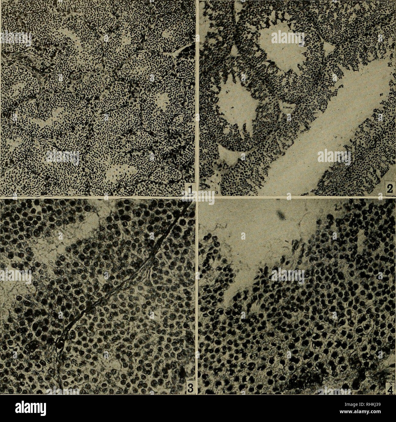 . The Biological bulletin. Biology; Zoology; Marine biology. 146 CLARENCE D. TURNER are partly closed by a loose syncytium, the interspaces of which often contain degenerating cells. No spermatids or spermatozoa are present and mitotic divisions are seldom encountered (Fig. 3). Many degen- erating epithelial cells with pycnotic nuclei are present throughout the. Fig. 1. An involuted testis from a control. Bouin-hematoxylin. X 55. Fig. 2. An involuted testis subsequent to 30-day treatment with Antuitrin-S (total 600 r. u.). Bouin-hematoxylin. X 55. Fig. 3. Higher magnification of a portion of F Stock Photo