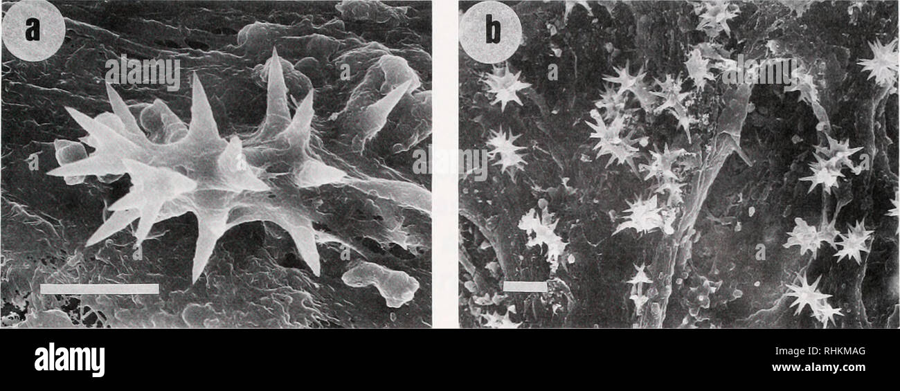 . The Biological bulletin. Biology; Zoology; Biology; Marine Biology. REPRODUCTION OF LATRUNCULIID SPONGE 311. Figure 5. Latrunculia magnified typical discorhabd microscleres. (a) A spicule embedded in spongin. Scale bar = 10 ^m (SEM). (b) A layer of discorhabds near the sponge's surface. Scale bar-20 &gt;im (SEM). ing many months of the year serves to confirm this con- clusion. An extended reproductive season has been found among other brooding sponges in the Red Sea (Ilan and Loya, 1988, 1990; Ilan and Vacelet, 1993). This strategy could be a means of ensuring settlement on vacant spots as t Stock Photo
