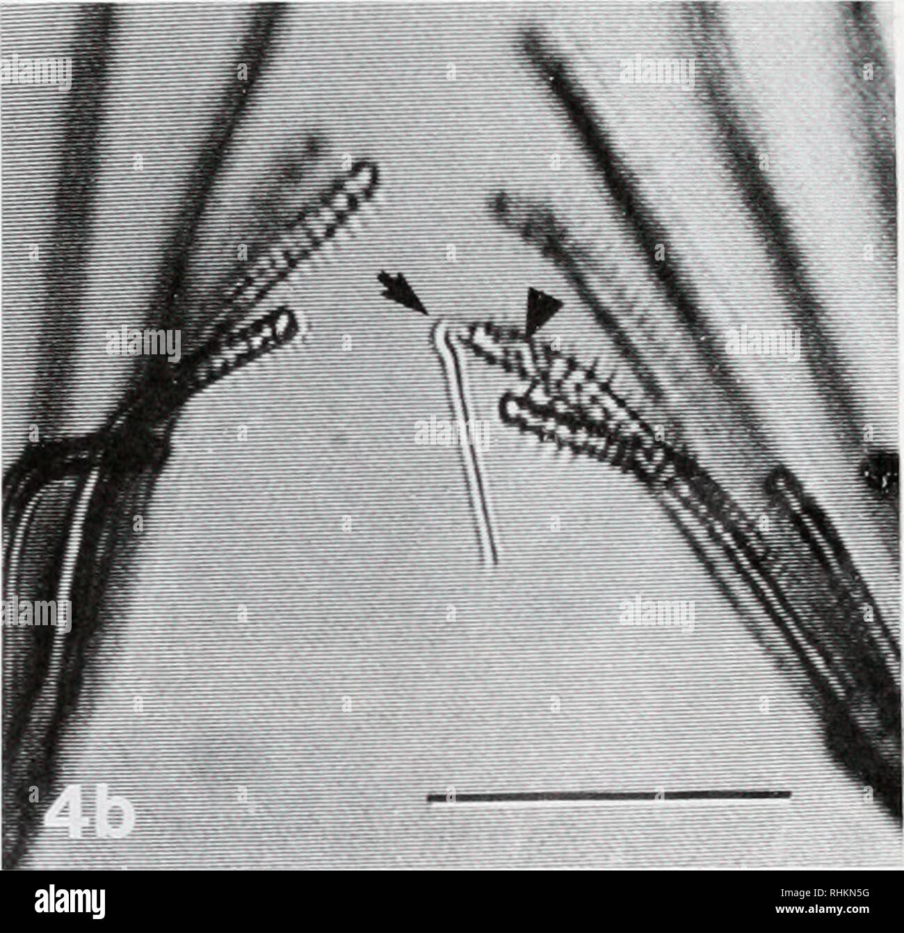 . The Biological bulletin. Biology; Zoology; Biology; Marine Biology. Figure 1. Differential interference contrast image of a partially disassociated spetmatozeugma. The arrow indicates the head regions of spermatozoa that have remained joined. The tail region of the spermatozeugma has remained intact. Scale bar = 12 jim. Figure 2. Video image of spermatozeugmata (arrow) and a primary oocyte (O) positioned between the pharynx (PH) and body wall of an extended polypide. The intertentacular organ (ITO) consists of a proximal and distal chamber. Scale bar = 50 /itn. Figure 3. A video image of thr Stock Photo