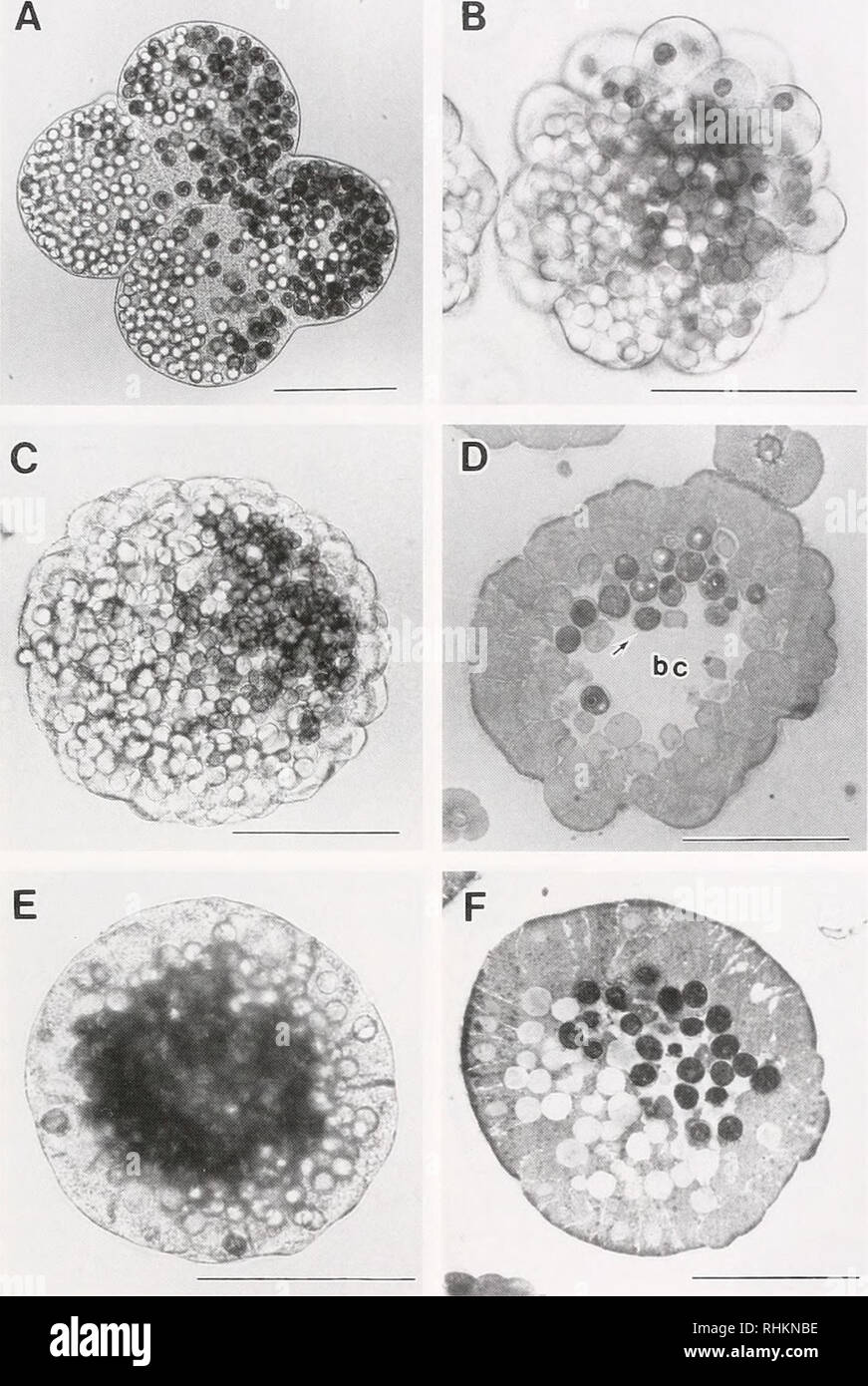 Morula Embryo High Resolution Stock Photography And Images Alamy The blastomeres thus produced become clustered together to form a solid cellular ball called morula. https www alamy com the biological bulletin biology zoology biology marine biology zooxanthellate eggs of corals 71 b figure 2 early development of pocilloptmi verrucosa four cell stage to gastrula a four cell stage the second cleavage plane was normal to the first cleavage plane thus dividing the blastomere into a zooxanthellae rich blastomere and a lipid droplet rich blastomere b morula stage embryo blastomeres are round some contain a single zooxanthellae cl blastula zooxanthellae are still restricted to one hemisphere d section of a blastula blastomeres containing one or more zooxa image234617810 html