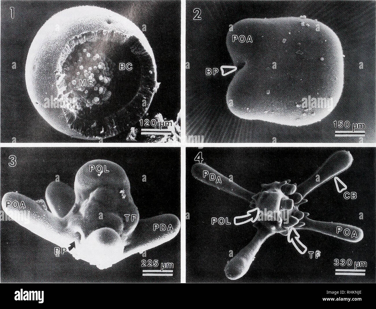 The Biological Bulletin Biology Zoology Biology Marine Biology 80 R R Olson Et Al Figure 1 Scanning Electron Micrograph Of A Fractured Gastrula Of Phyllacanlhus Imperialis Showing Mesenchyme Cells Me Aggregated