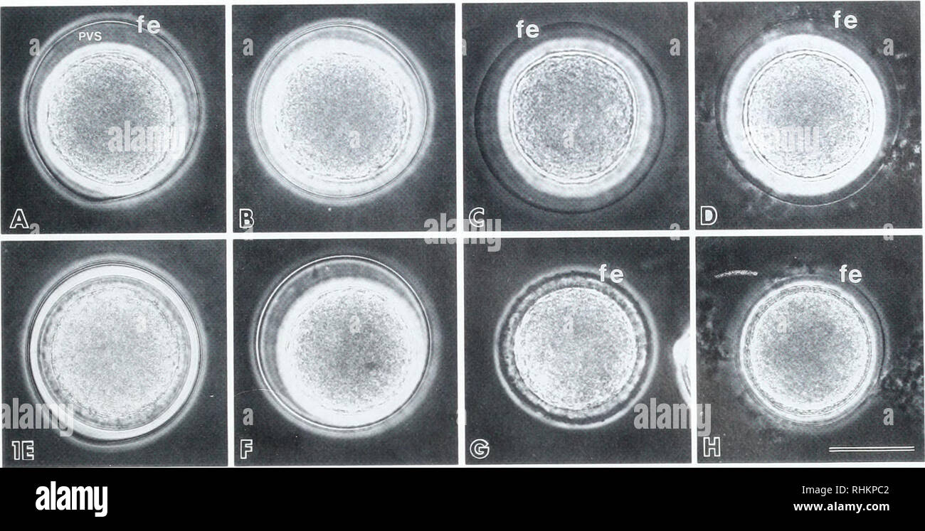 The Biological bulletin. Biology; Zoology; Biology; Marine Biology.  FERTILIZATION ENVELOPE ASSEMBLY 349. Figure 1. Phase microscopy of  Strongylocentrotus piirpiiranix eggs activated in normal (A. E) and Na*  depleted SWs (B-D and