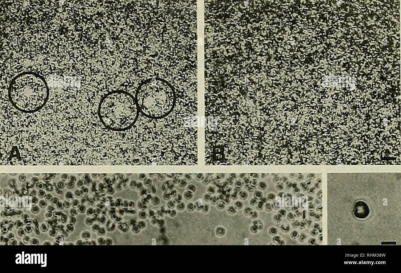 Lysis plaques hires stock photography and images Alamy