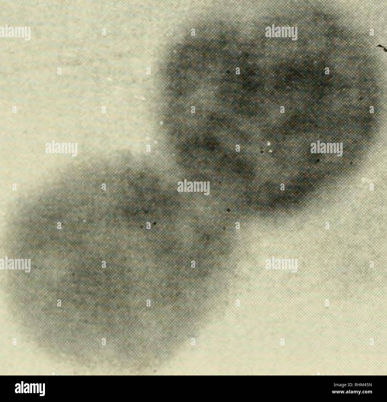 Autoradiographic hires stock photography and images Alamy