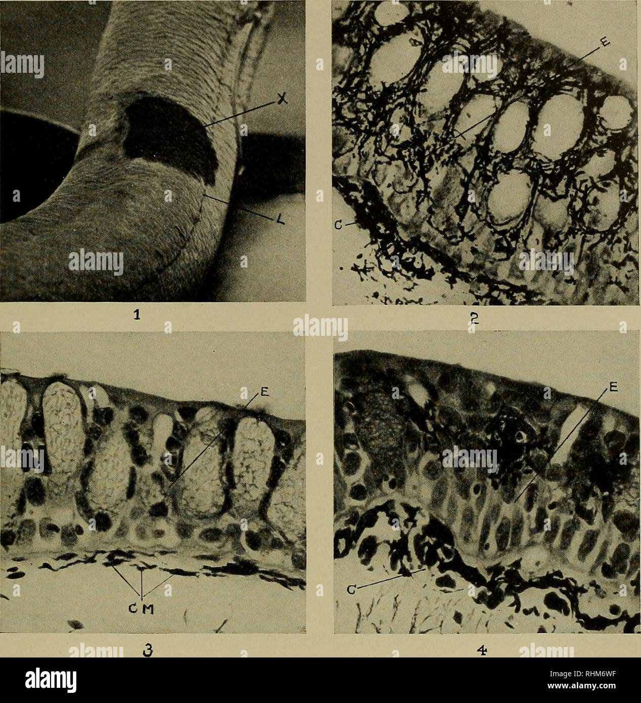 . The Biological bulletin. Biology; Zoology; Marine biology. CUTANEOUS MELANOSIS IN LUNGFISHES 283. Plate I EXPLANATION OF PLATE I Fig. 1. Lepidosiren paradoxa (lungfish A) with pigmented patch {X) in the right dorsal region encroaching on the lateral line (L). Fig. 2. Photomicrograph of melanotic tissue removed from lungfish A, showing a hyperplasia of melanophores infiltrating thickened epidermis (£). Numerous melanophores in the corium (C). Rogers' silver stain, counterstained faintly with erythrosin. X 250. Fig. 3. Normal skin removed from lungfish B. E. epidermis; CM. corial melanophores. Stock Photo