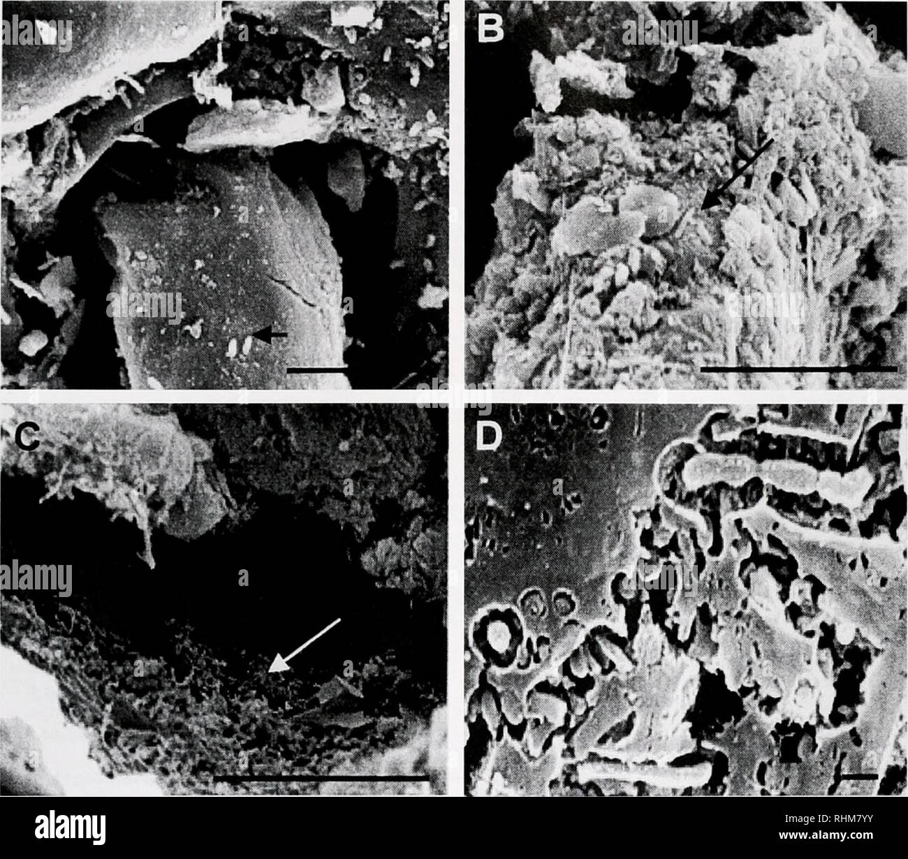Sem bacteria various hi-res stock photography and images - Alamy