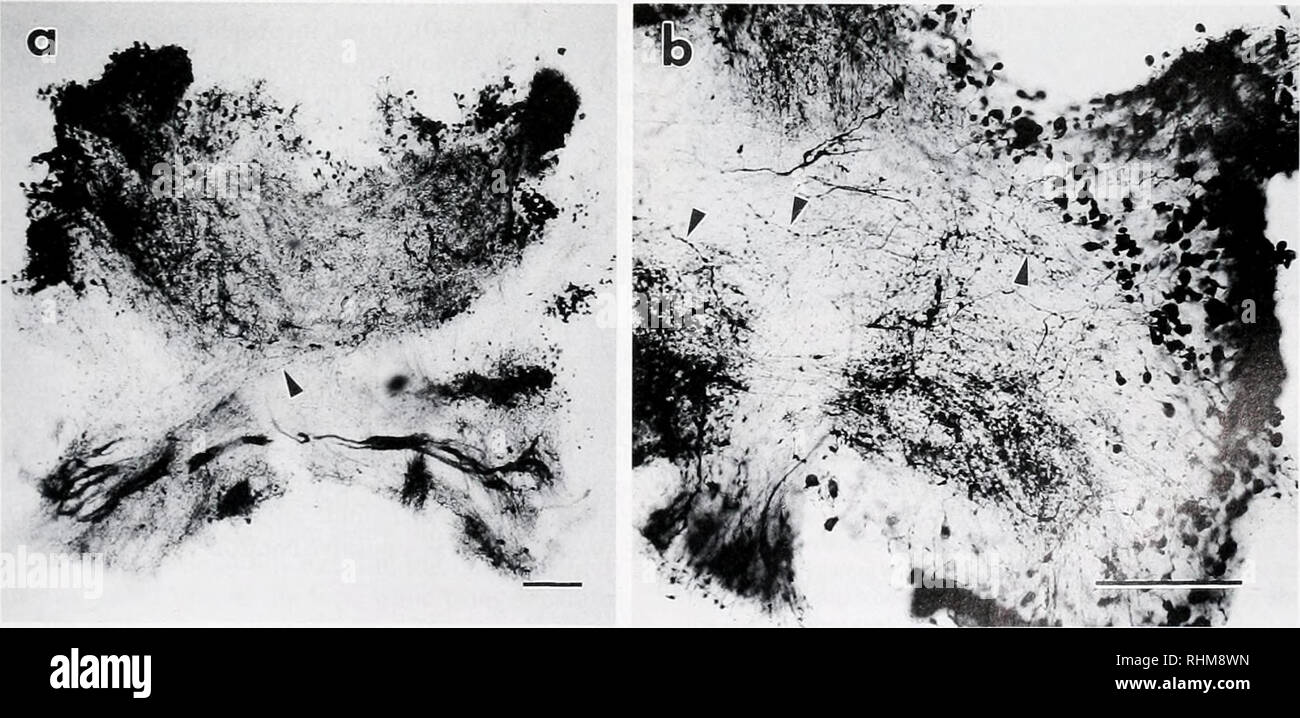 9 Tissues High Resolution Stock Photography And Images Alamy