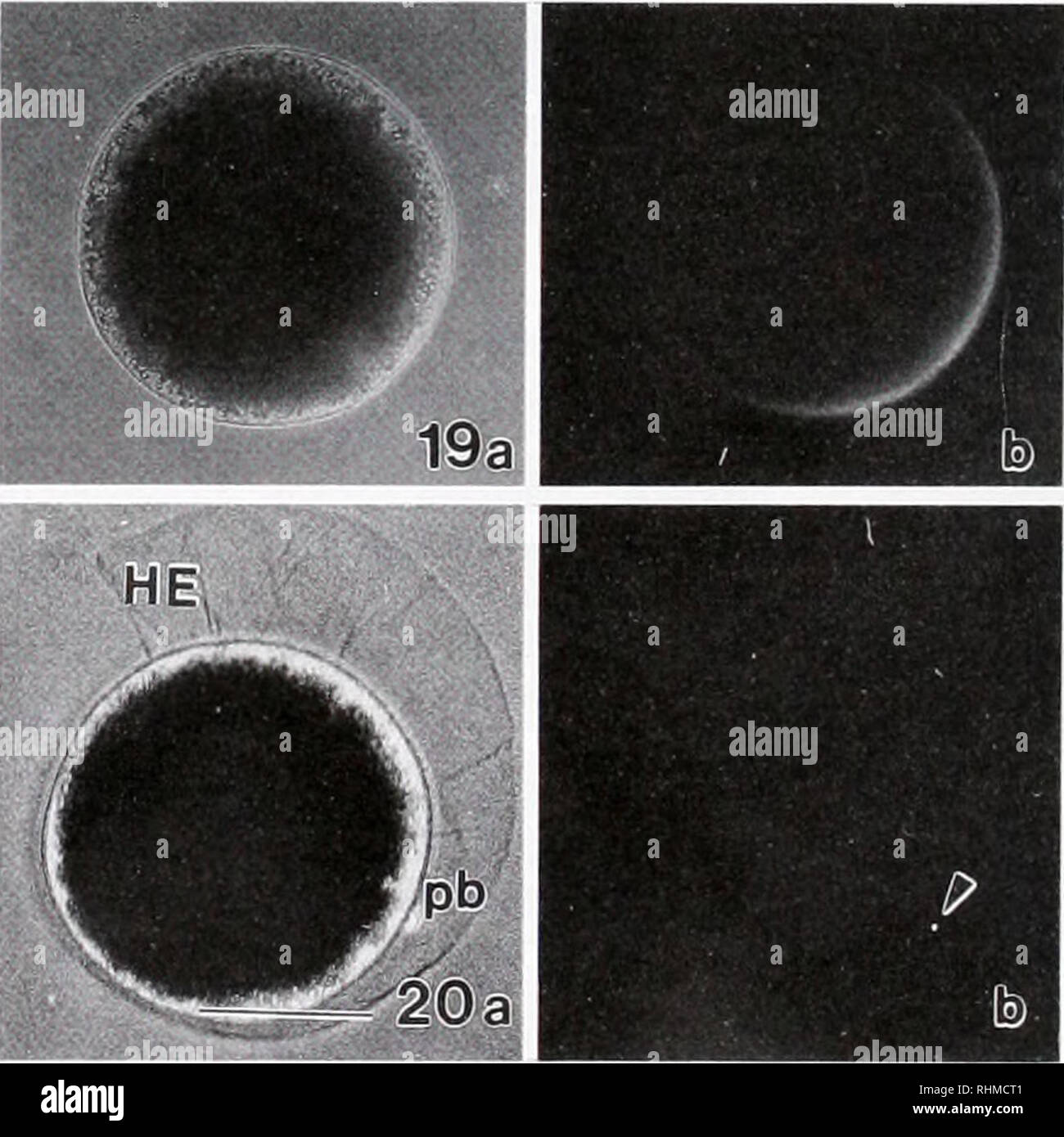Fluorescent labels and light microscopy