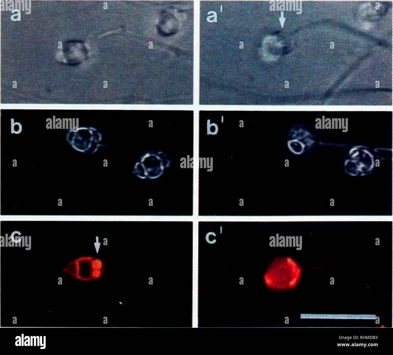 Confocal microscopy hi-res stock photography and images - Alamy