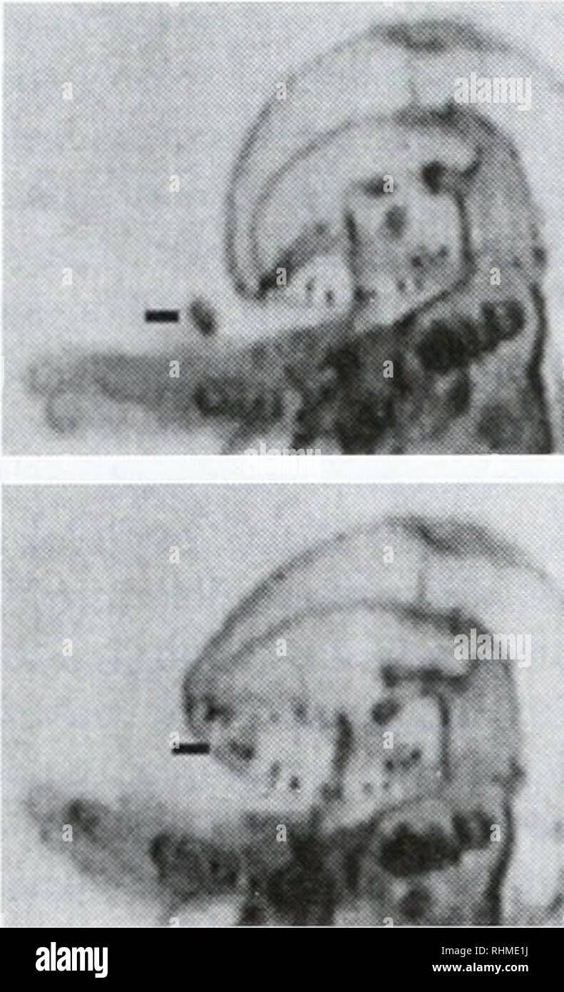 . The Biological bulletin. Biology; Zoology; Biology; Marine Biology. FEEDING BY PHORONID LARVAE 159. 0 0.1. Please note that these images are extracted from scanned page images that may have been digitally enhanced for readability - coloration and appearance of these illustrations may not perfectly resemble the original work.. Marine Biological Laboratory (Woods Hole, Mass. ); Marine Biological Laboratory (Woods Hole, Mass. ). Annual report 1907/08-1952; Lillie, Frank Rattray, 1870-1947; Moore, Carl Richard, 1892-; Redfield, Alfred Clarence, 1890-1983. Woods Hole, Mass. : Marine Biological La Stock Photo