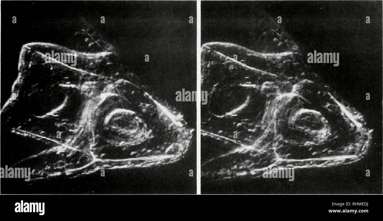 . The Biological bulletin. Biology; Zoology; Biology; Marine Biology. CELL DIVISION. CELL MOTILITY, AND DEVELOPMENT 233. Figure 1. Swimming pluteus larva of Lytechinus variegatus (sea urchin). The stereo pair is arranged for cross-eved viewing. Each view wax computed from a stack ofca. 100 optical sections which were acquired in DIC microscopy at 30 sections/s, then digitally processed to remove out-of-focus hu:c digital contrast enhancement (3). We also described a method for very rapidly obtaining serial optical sections, repeatedly in time lapse, using video microscopy combined with synchro Stock Photo
