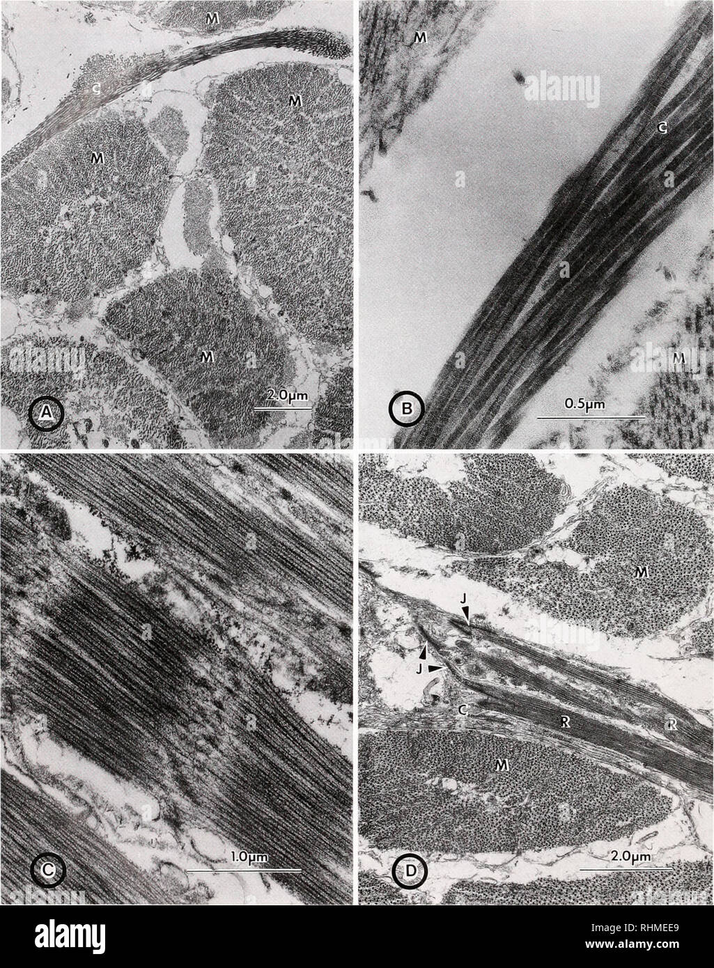 Muscle fibers micrograph hi-res stock photography and images - Alamy