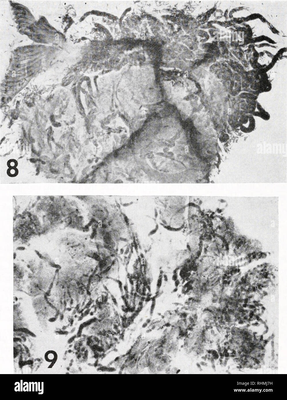. The Biological bulletin. Biology; Zoology; Biology; Marine Biology. [06 HORACE Y. STUNKARD. FIGURE 8. Pressed preparation of the tissues of the clam, Lyonsia hyalina, infiltrated with branching sporocysts of Rhipidocotyle sp. FIGURE 9. Smear preparation of the tissues of the clam, Lyonsia hyalina, infiltrated with branching sporocysts of Rhipidocotyle sp. TAXONOMY The trematode family Bucephalidae Prosorhynchoides gracilescens nczv combination: validation of Prosorhynchoides iljus, 1929. Rudolphi (1819) described three species of bucephalid worms from ine fishes: Distoma gracilescens from L Stock Photo