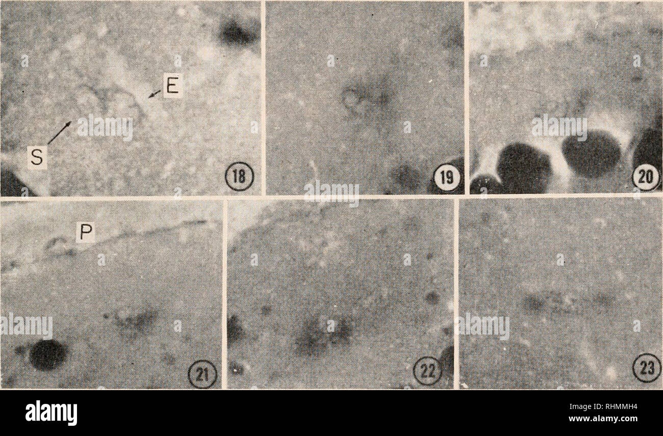 Pronuclei hires stock photography and images Alamy