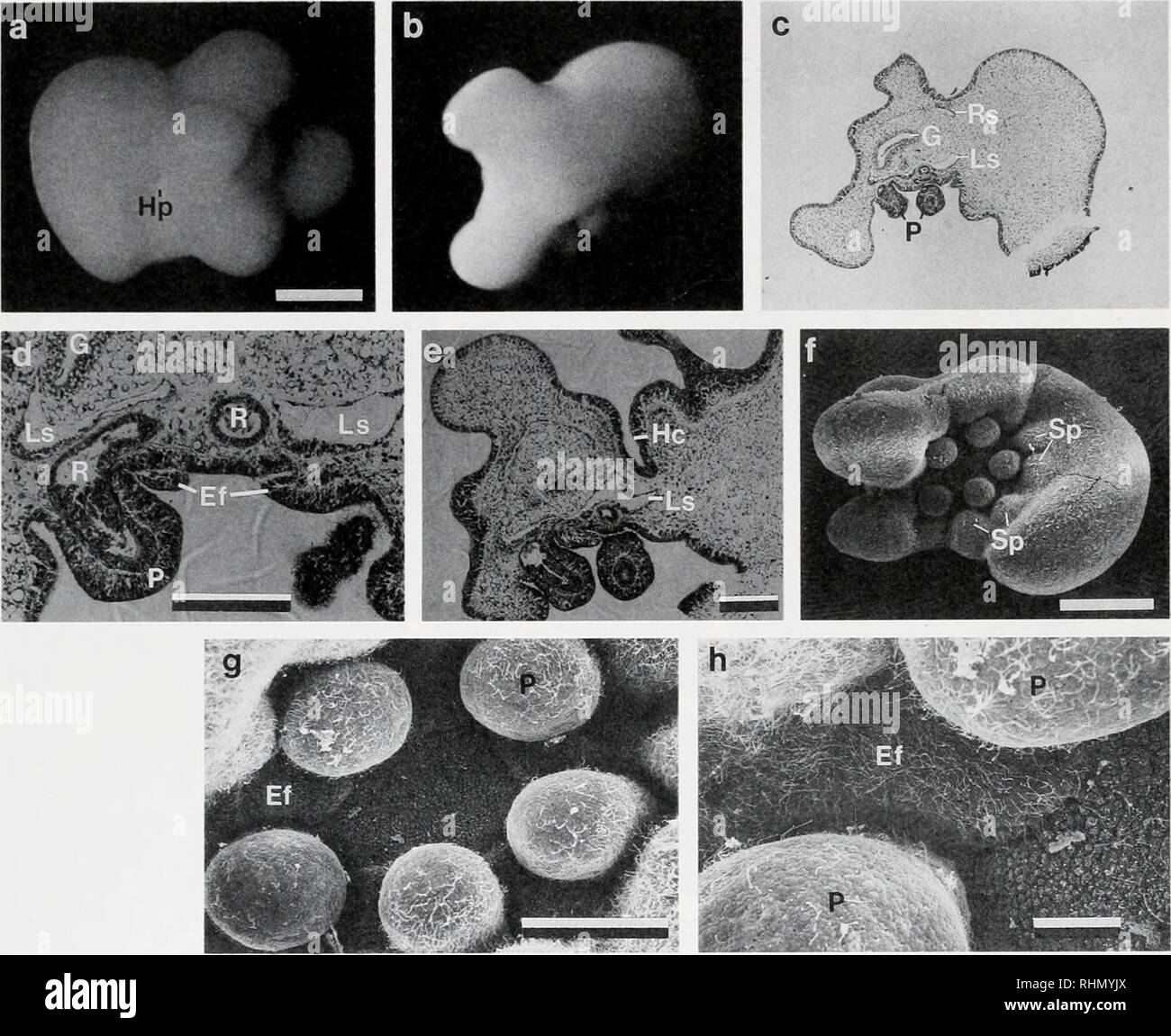 . The Biological bulletin. Biology; Zoology; Biology; Marine Biology. ECHINOTHURIOID DEVELOPMENT, REVISITED 23. Figure 7. A 101-h larvae of Asthenosoma ijimai. a. Light micrograph of dorsal side of live specimen. Note the hydropore (Hp) and four para-arms (to right). The anterior end is to the left of figure. Scale bar, 0.5 mm. b. Light micrograph of ventral side of live specimen. The anterior end is to the right of figure. Same scale as a. c. Medial frontal section through larva shows developing internal structures and juvenile oral region. P, podia; Rs, right somatocoel; Ls. left somatocoel; Stock Photo