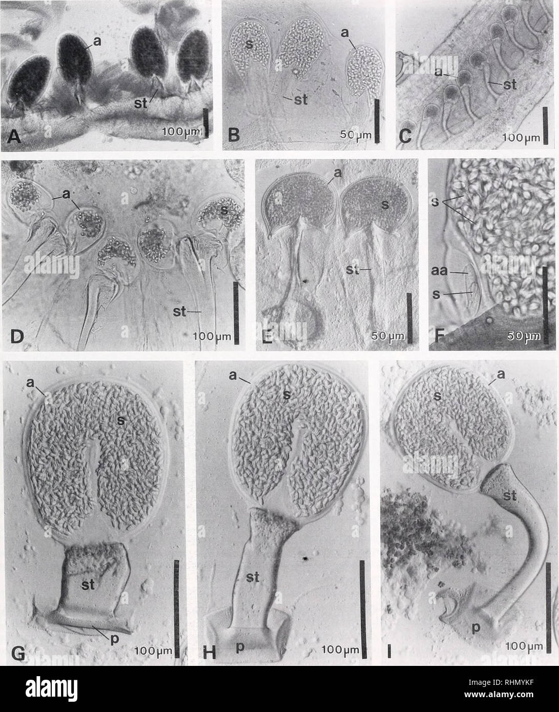 . The Biological bulletin. Biology; Zoology; Biology; Marine Biology. HERMIT CRAB SPERMATOPHORE DIVERSITY 243. Figure 2. Light micrographs of spermatophores of hermit crabs. (A) Coenobita brevimanus (Coenobitidae). (B) Dardanus megislos (Diogemdae). (C) Caleinus latent (Diogenidae). (D) Dardanu.t lagopodes (Diogenidae). Note the double-headed spermatophores. (E) Clibanarius corallinus (Diogenidae). (F) Pagunis hinimamit (Pagundae). Detail of the accessory ampulla containing a single spermatozoa. (G-I) Diogenes gardineri (Diogenidae). Series of three micrographs from the proximal to the distal  Stock Photo