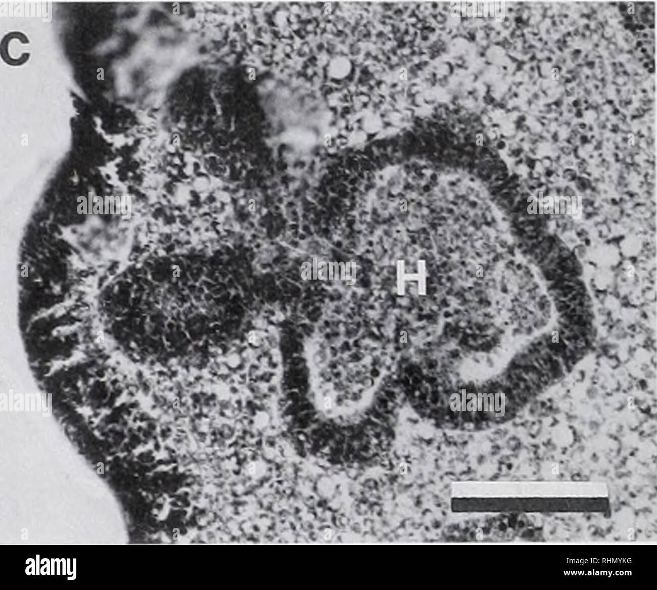 . The Biological bulletin. Biology; Zoology; Biology; Marine Biology. Figure 6. A 75.5-h larvae of Asthenosoma ijimai. a. Light micrograph of live specimen shows five primary podia just beginning to form on left side of larva. Scale bar, 0.5 mm. b. Frontal section with continued hydrocoelic (and podial) development. The hydrocoel (H) is almost completely separated from the archenteron (A). Same scale as a. c. Detail of hydrocoel (H) with parts of two podial extensions from a different section of the same larva as b. Scale bar. 100 ^m. showed the hydrocoelic compartments with thickened epitheli Stock Photo