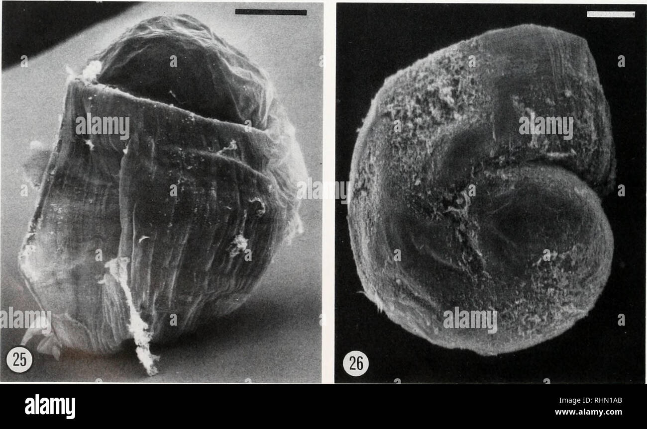 Double Ridge Micrograph 1940a High Resolution Stock Photography and Images - Alamy