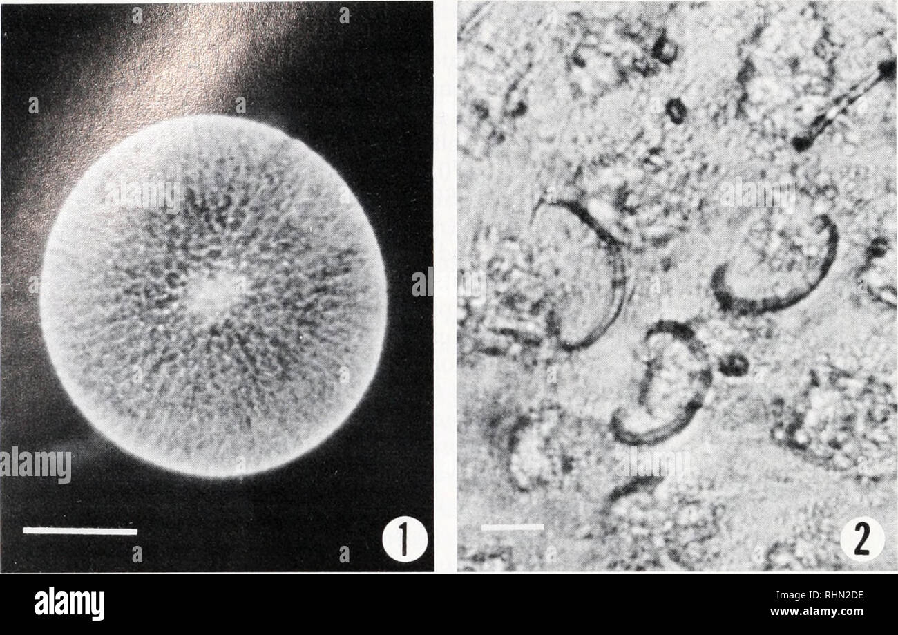 . The Biological bulletin. Biology; Zoology; Biology; Marine Biology. 178 O. R. ANDERSON ET AL.. 2 FIGURE 1. A living Physematium muelleri with prominent intracapsular lobes and a centrally located nucleus. Bar = 1 mm. FIGURE 2. Siliceous spicules on the surface of the central capsular wall of P. muelleri. Bar = 20 nm. are also observed in the regions of the cytoplasmic lobes where the ensembles of encircling mitochondria and dense granules are abundant. The capsular wall possesses numerous fusules (strands of cytoplasm) directed out- ward, forming continuity between the intracapsular lobes an Stock Photo