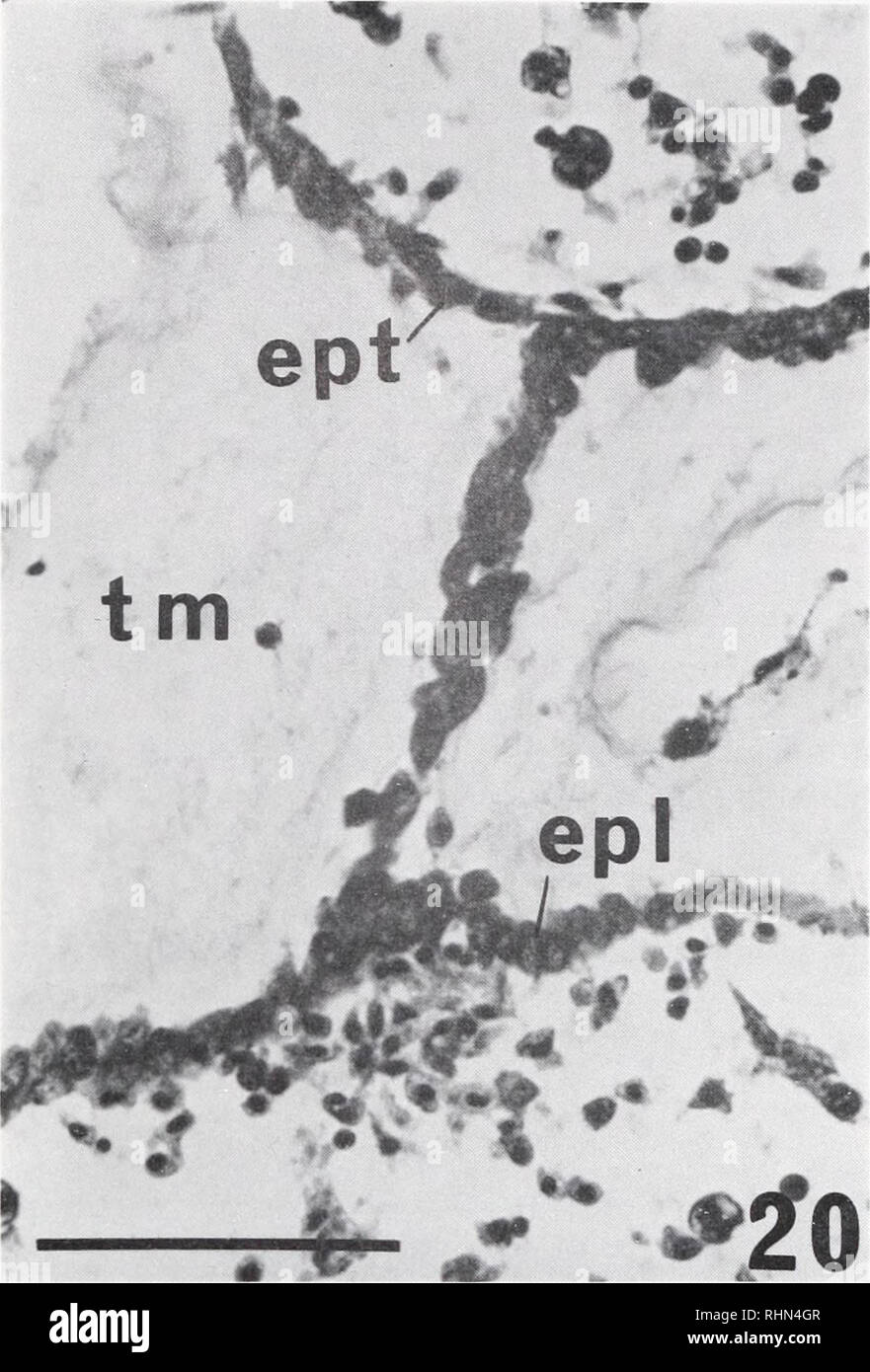 . The Biological bulletin. Biology; Zoology; Biology; Marine Biology. COLONY SPECIFICITY IN PEROPHORA 177. FIGURE 20. A histological figure of nonfusion type B, after detachment of the two stolons. Many amoebocytes were observed in the lumen of the 1-stolon. epl, epidermal cells of the 1-stolon; ept, epidermal cells of the t-stolon; tm, test matrix. Scale bar = 50 ^m. Fusibility between different colonies The two types of nonfusion did not take place at random. A particular com- bination of incompatible colonies always exhibited only one type of nonfusion. We first tested the fusibility of a c Stock Photo