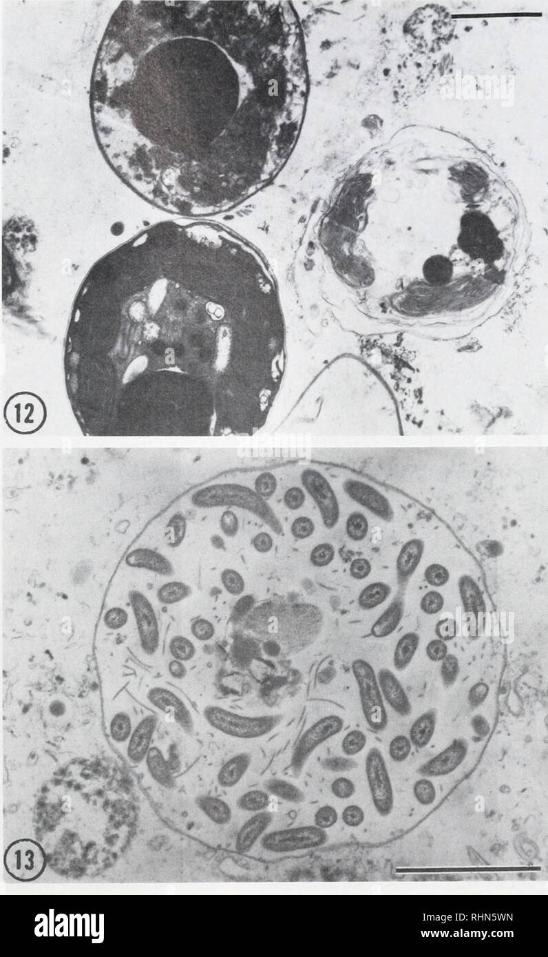 . The Biological bulletin. Biology; Zoology; Biology; Marine Biology. SYMBIOSIS IN TRIDACNA 189. FIGURE 12. Transmission electron micrograph of a section through a fecal pellet in the rectum of T. derasa showing one morphologically intact zooxanthella and two pycnotic algal cells. Scale bar = 2.8 fim. FIGURE 13. Transmission electron micrograph of a section through the rectum of T. squamosa showing the flagellated bacteria in a vesicle in the fecal pellet. Scale bar = 2 nm. 14), and sometimes seen also in connective tissue covering the kidneys, though never in the cells of the kidneys themselv Stock Photo