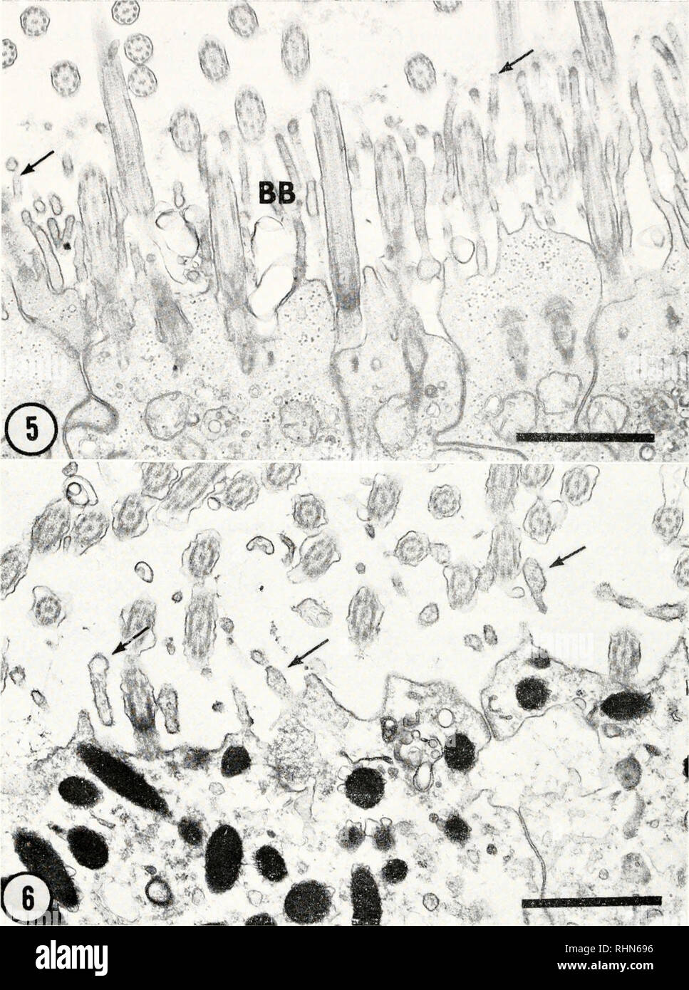 Cyto brush hires stock photography and images Alamy